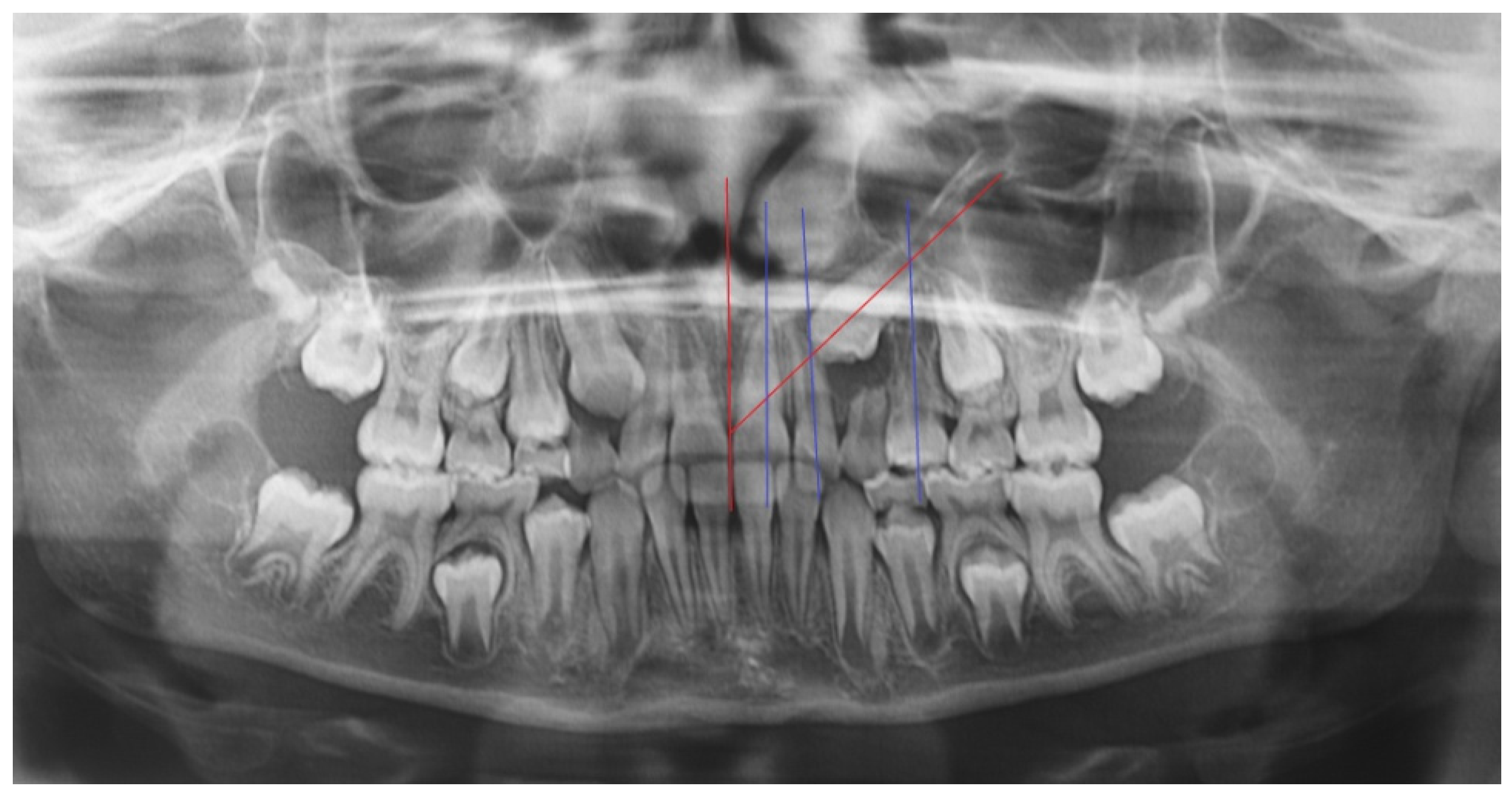 Mps 04 00057 g0a5 550