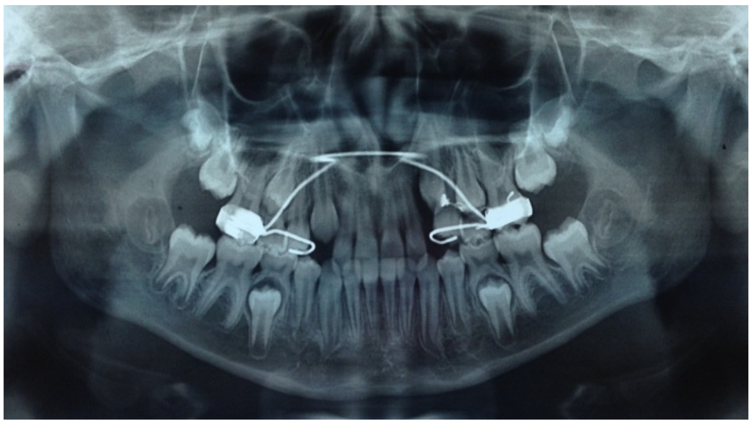 Mps 04 00057 g0a6 550