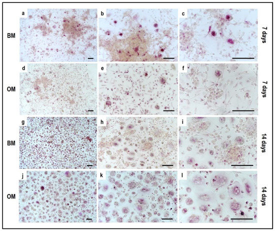 Colloblasts Example Protocol of Co-Culture of Human Osteoblasts and Osteoclasts to Test ...