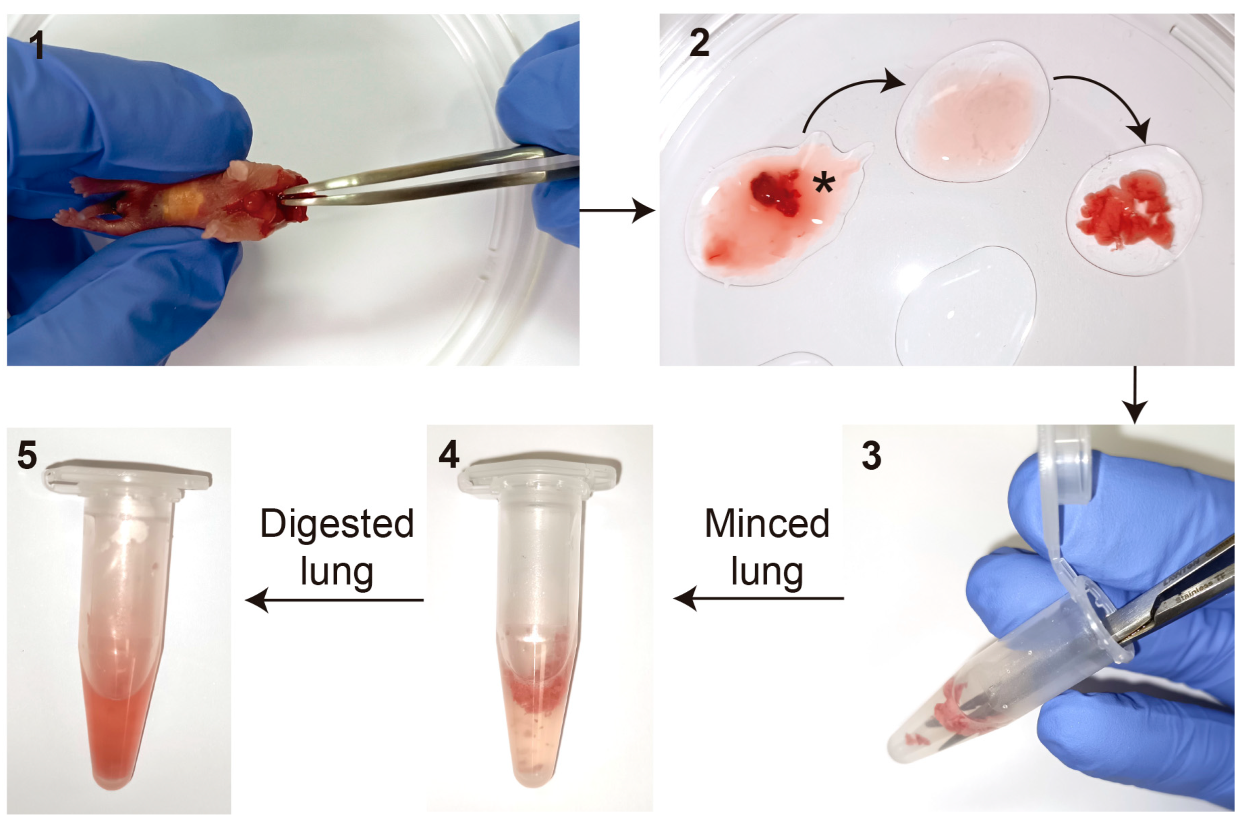 Blood Culture Ngtd - v8o98b9