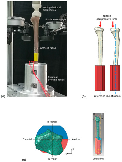 Practical Method to Evaluate the Stiffness of Fractured Radius
