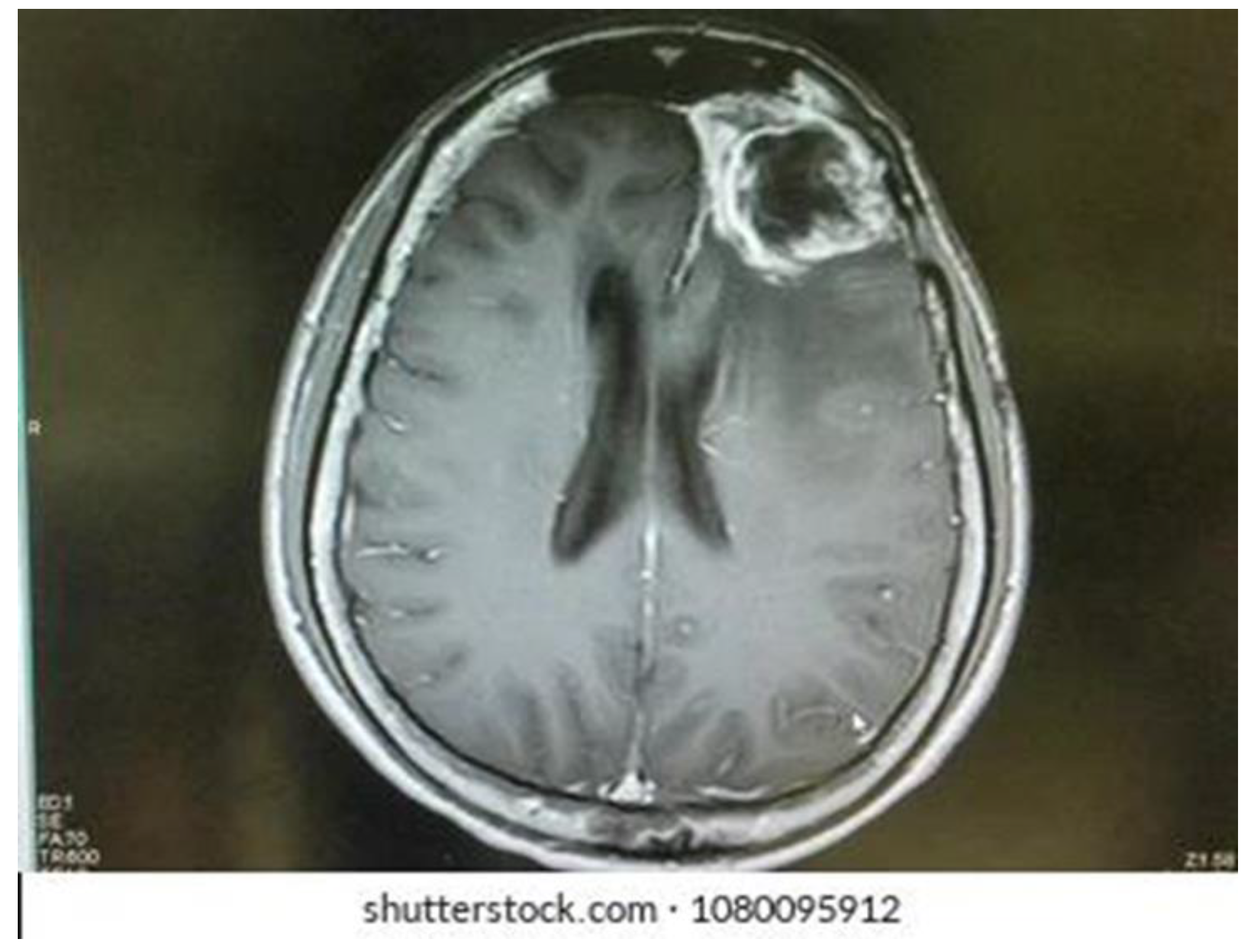 Msf 20 00009 g001 Msf 20 00009 g001