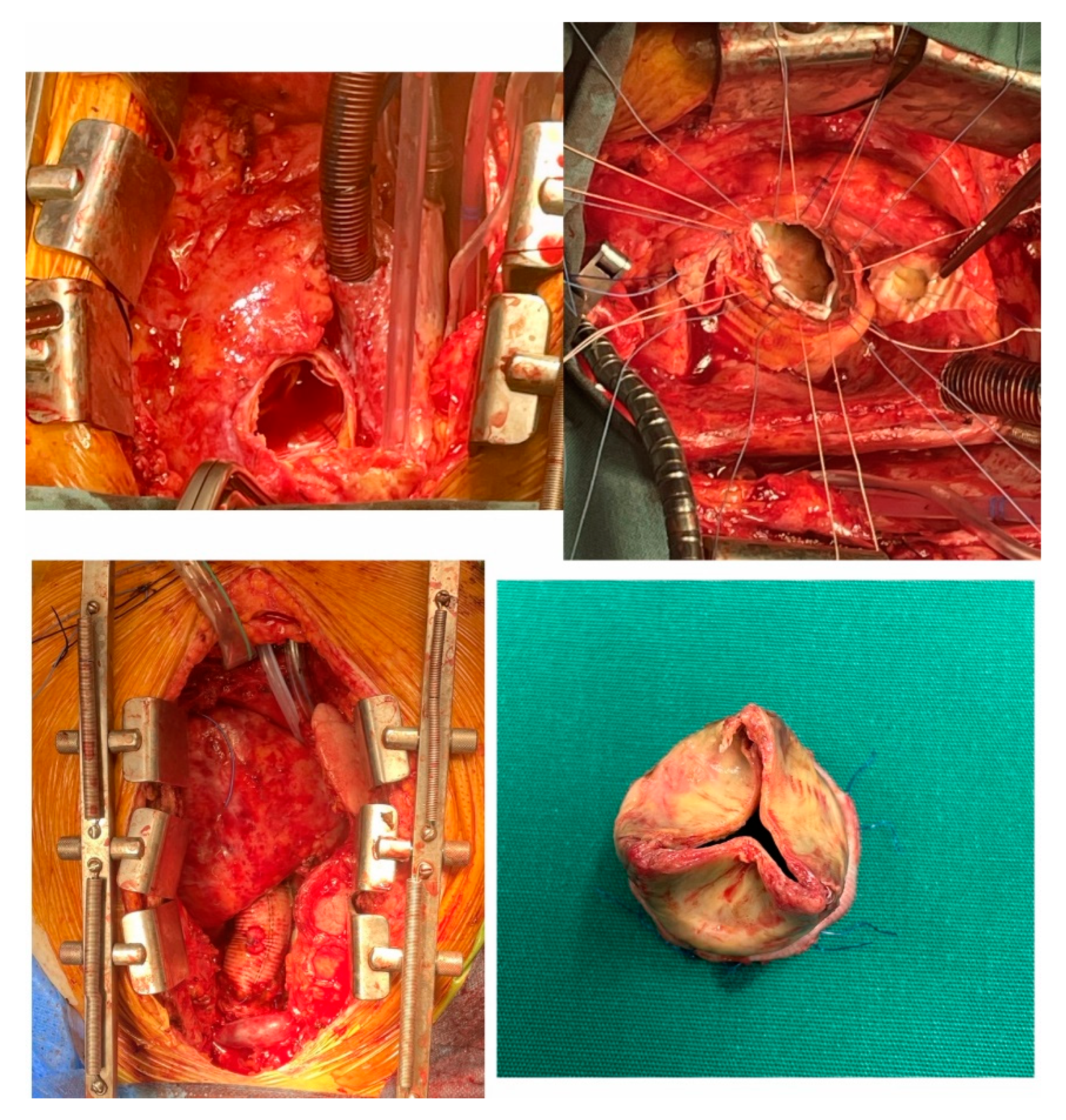 Bir sır perdesi aralanıyor