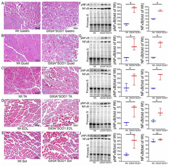Pathological Sequelae Associated with Skeletal Muscle
