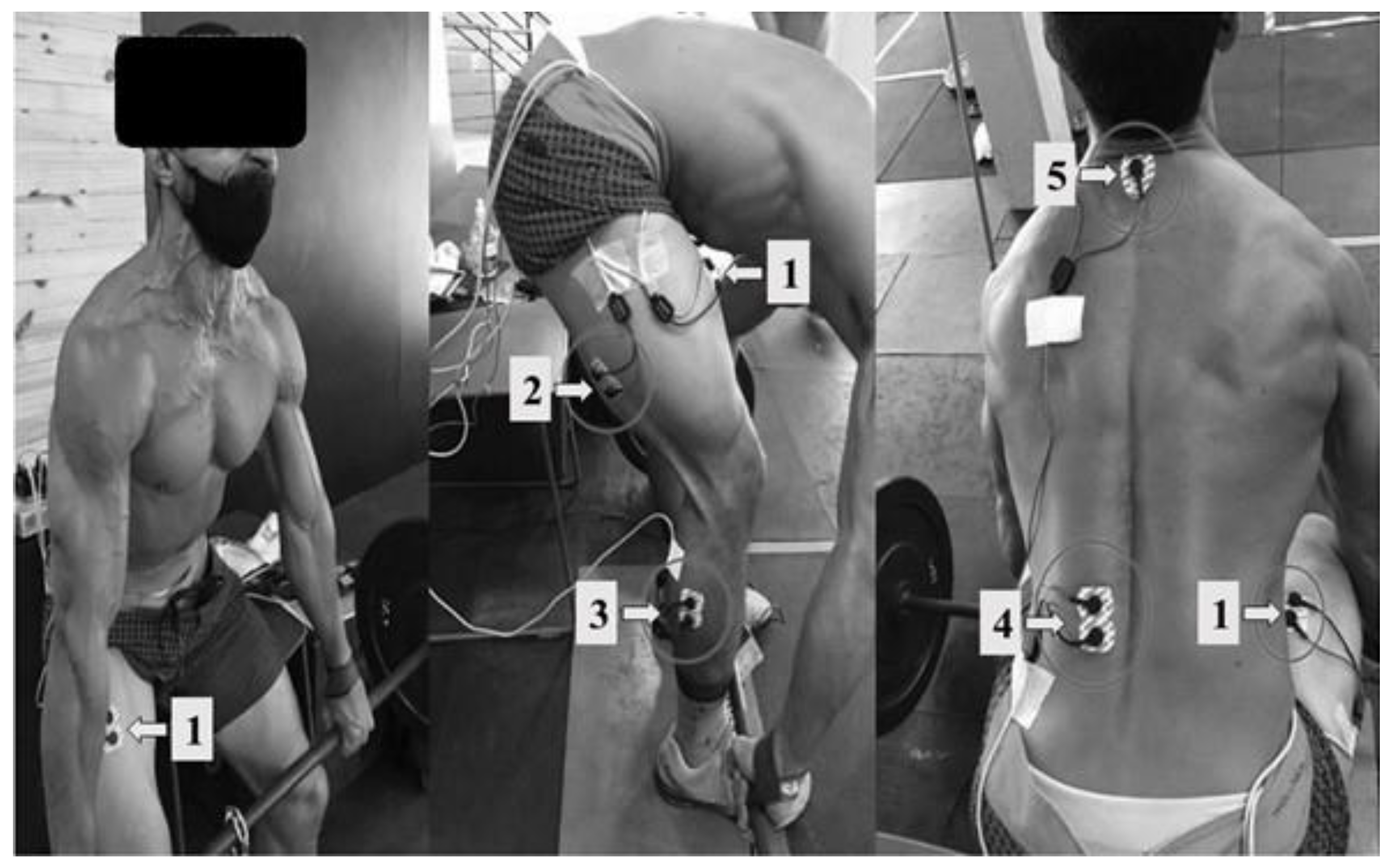 Muscles 02 00016 g004 Muscles 02 00016 g004