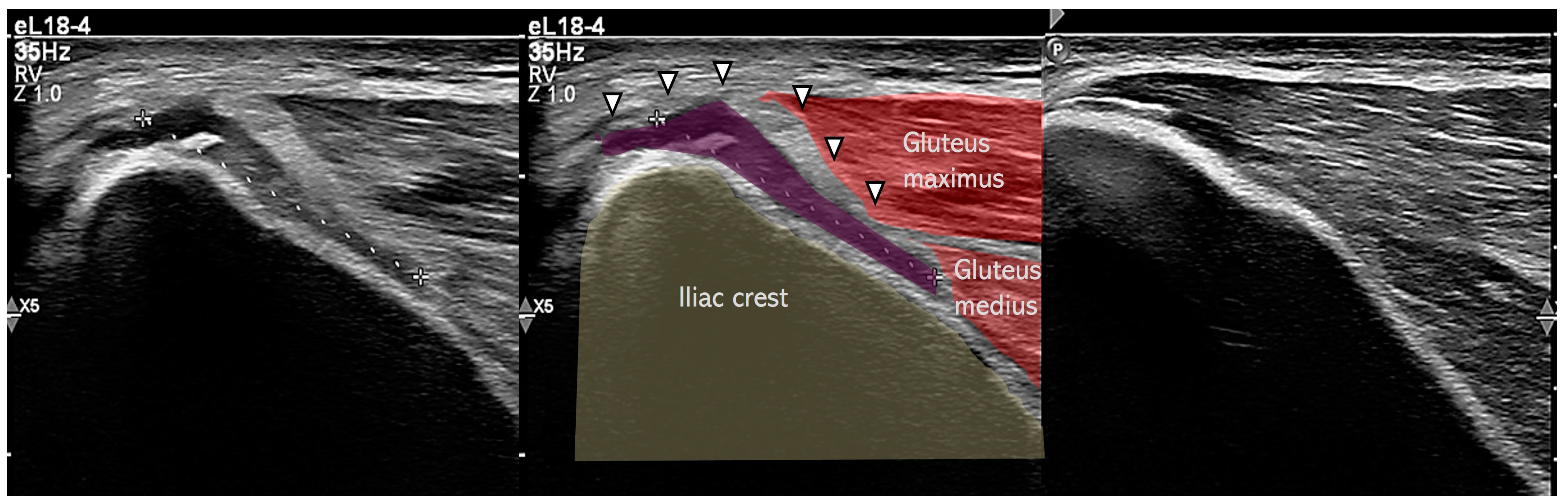 Muscles 04 00012 g004