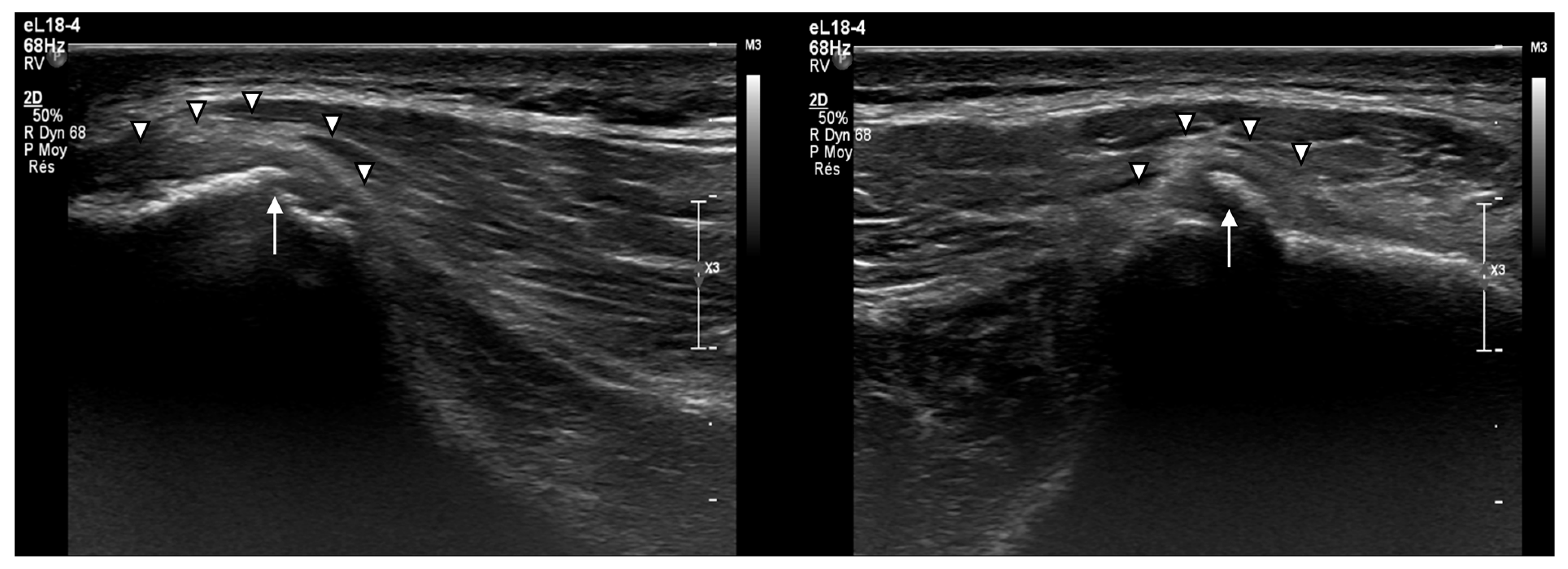 Muscles 04 00012 g006