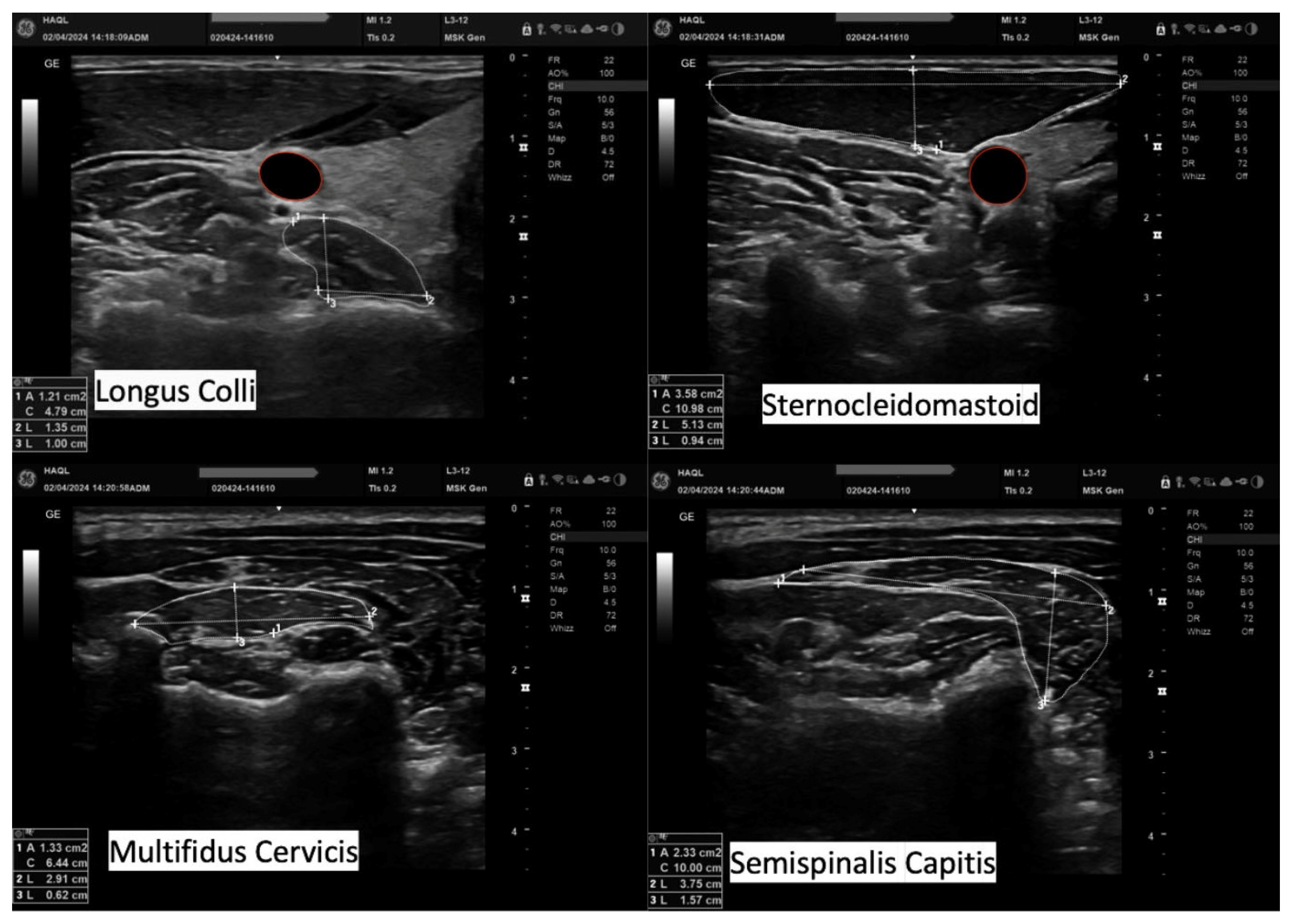 Muscles 04 00028 g003