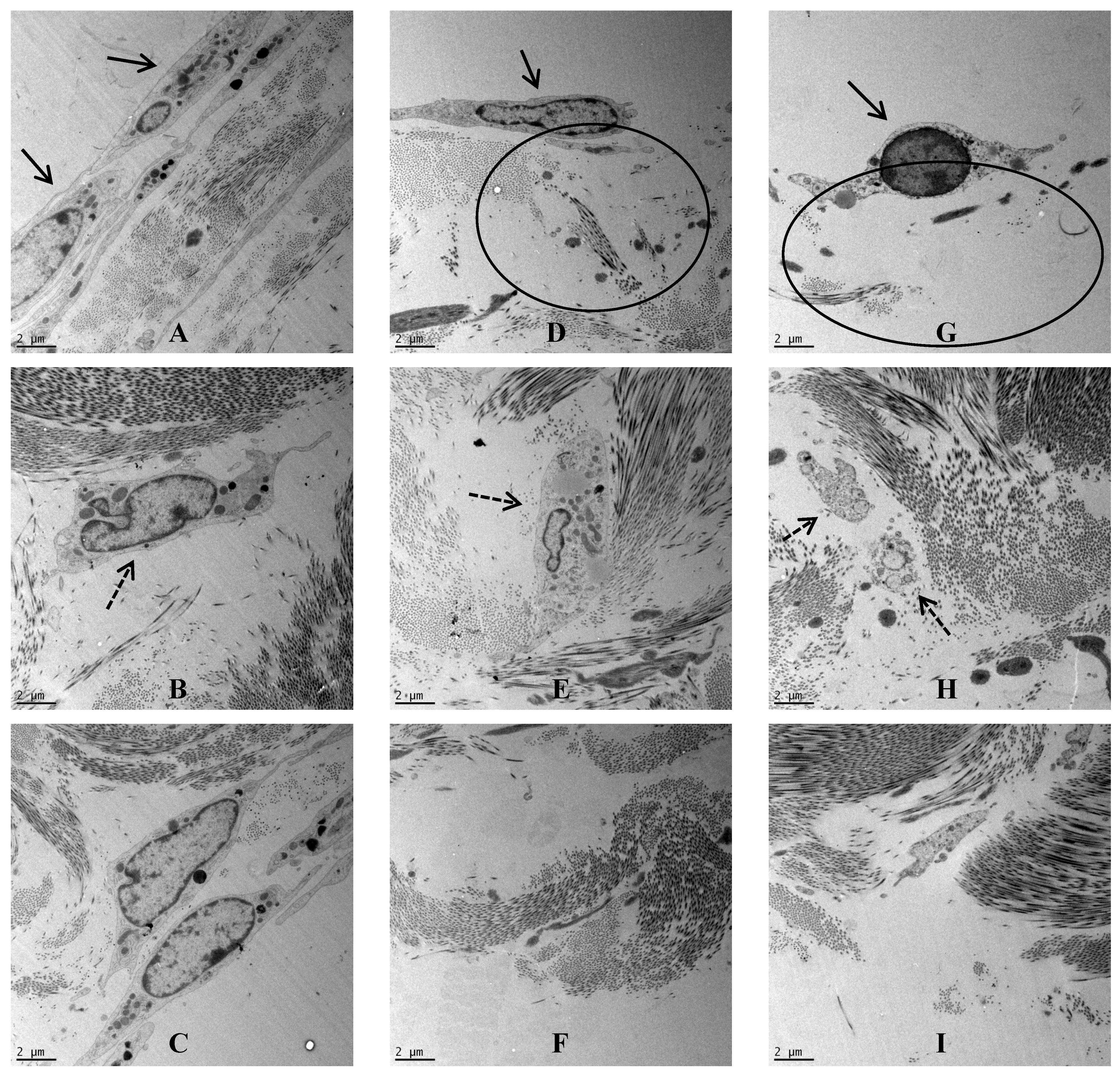 Regulation of MMP-3 expression and secretion by the chemokine eotaxin-1 in  human chondrocytes, Journal of Biomedical Science