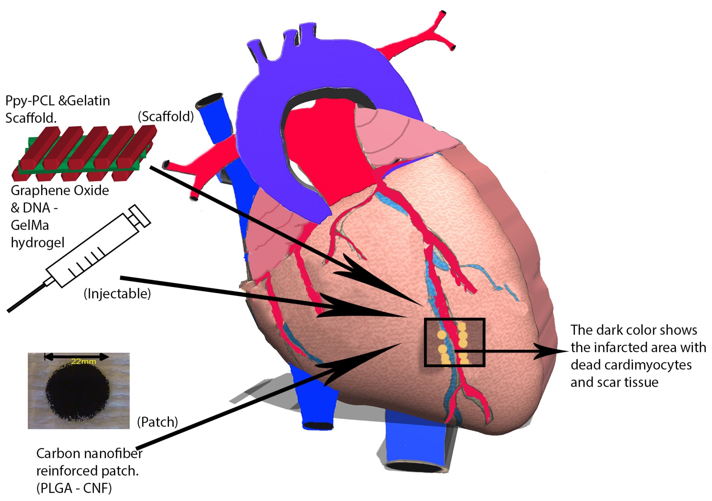 Nanomaterials | Free Full-Text | Nanomaterials for Cardiac Myocyte