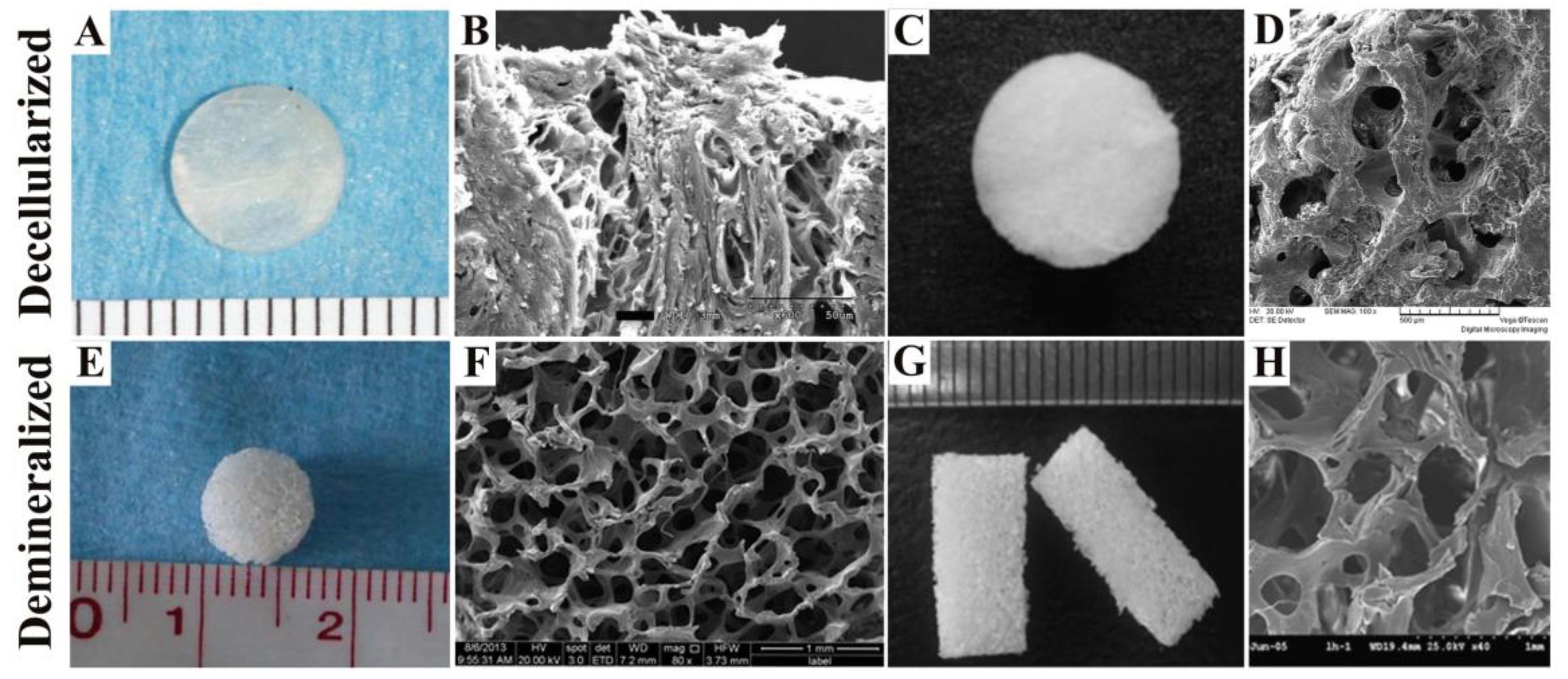 Reconstructing Bone with Natural Bone Graft A Review of In Vivo