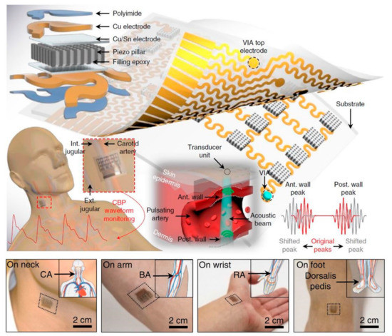 Evolution of Wearable Devices with Real-Time Disease Monitoring