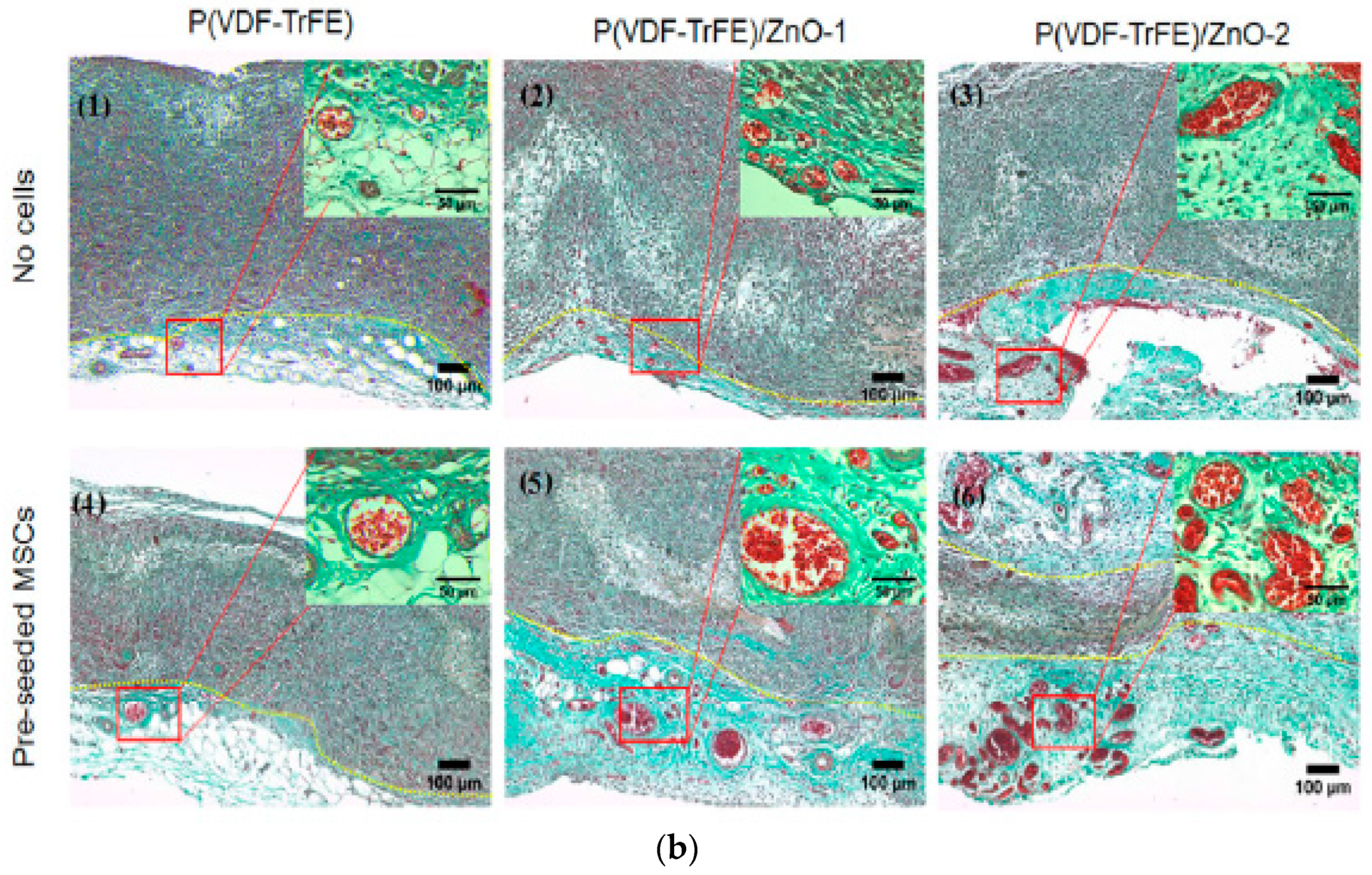 Nanomaterials 09 00952 g027b