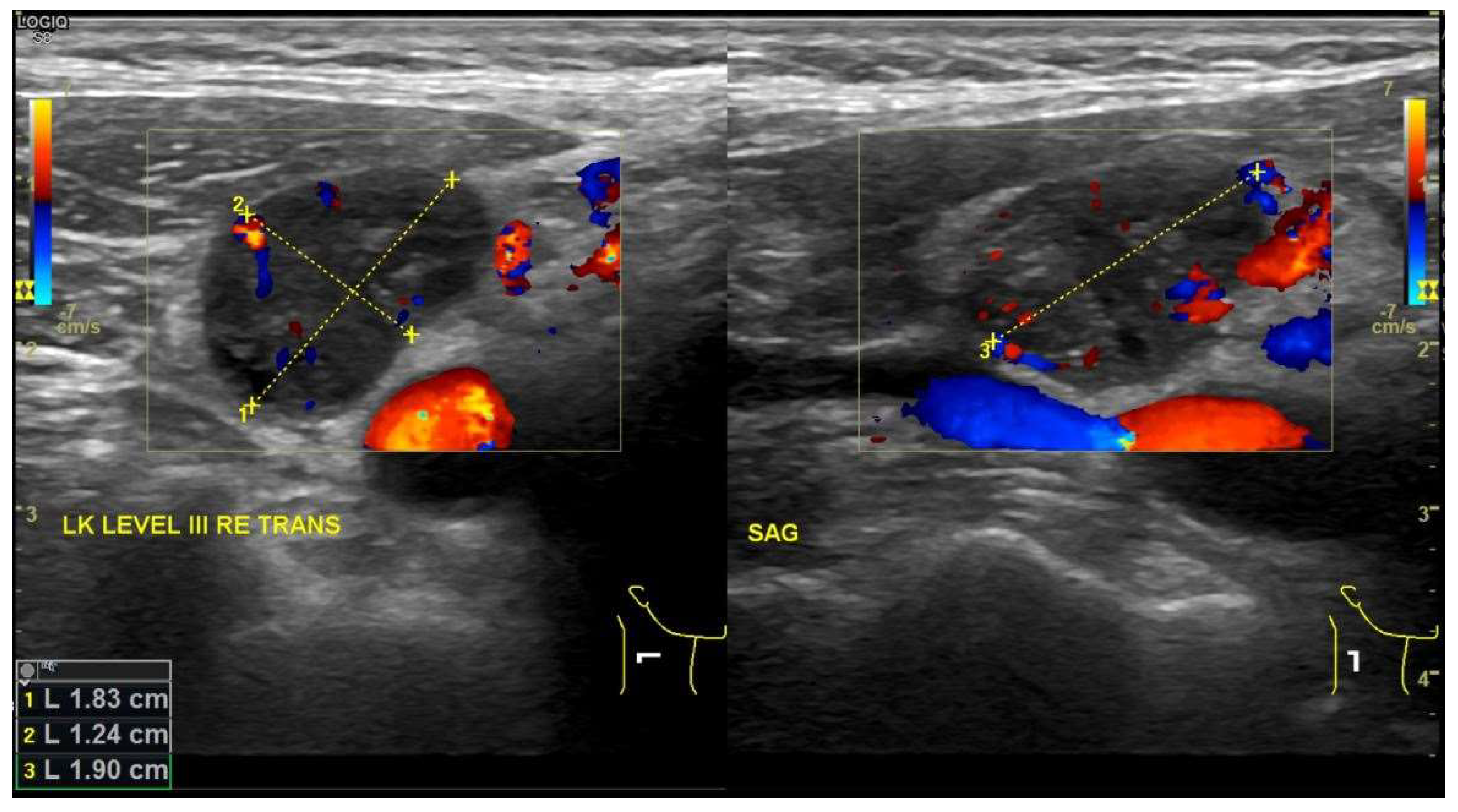 Nanomaterials 10 00383 g004