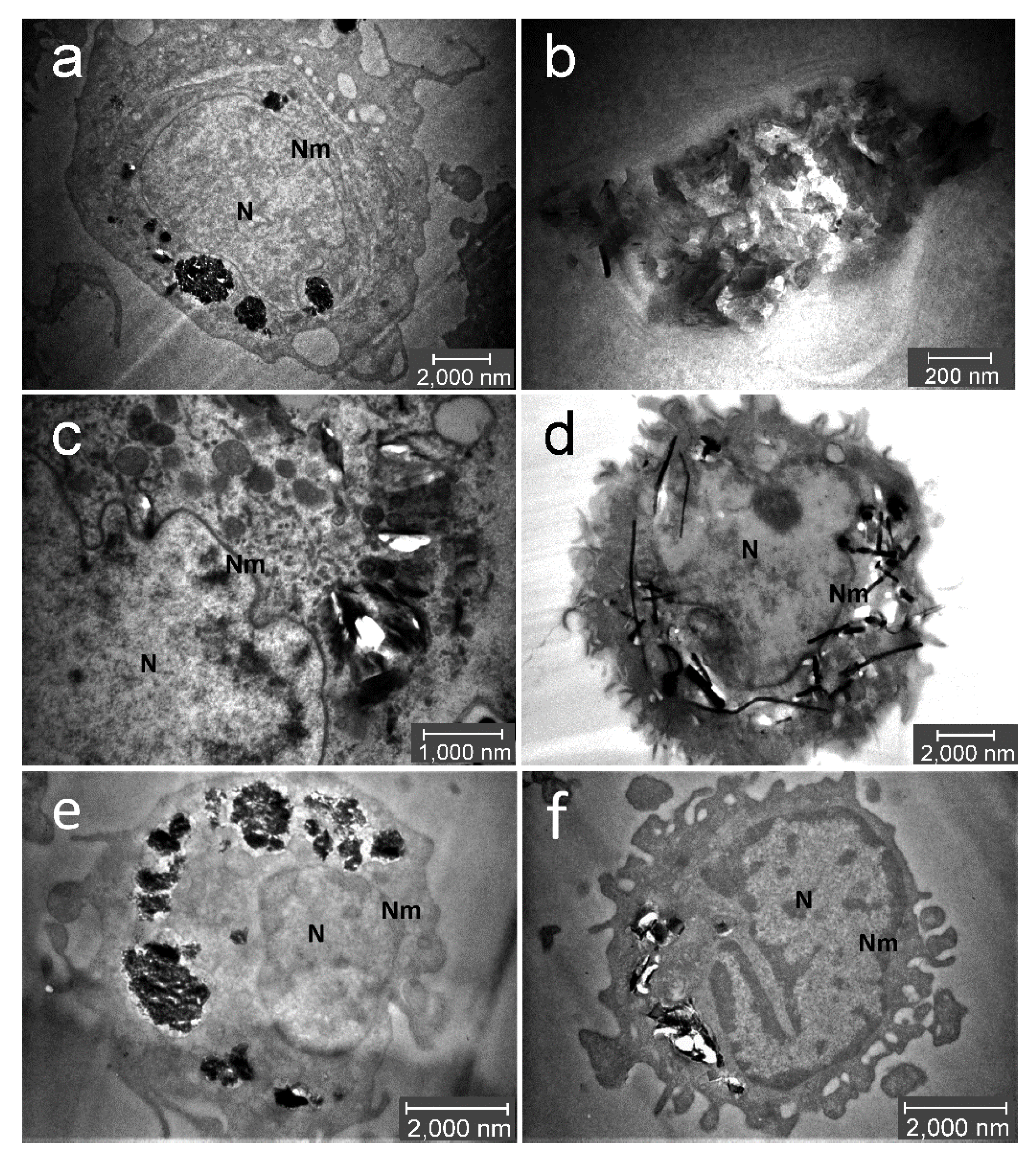 ハラ Indispensable Role of Proteases in Plant Innate Immunity