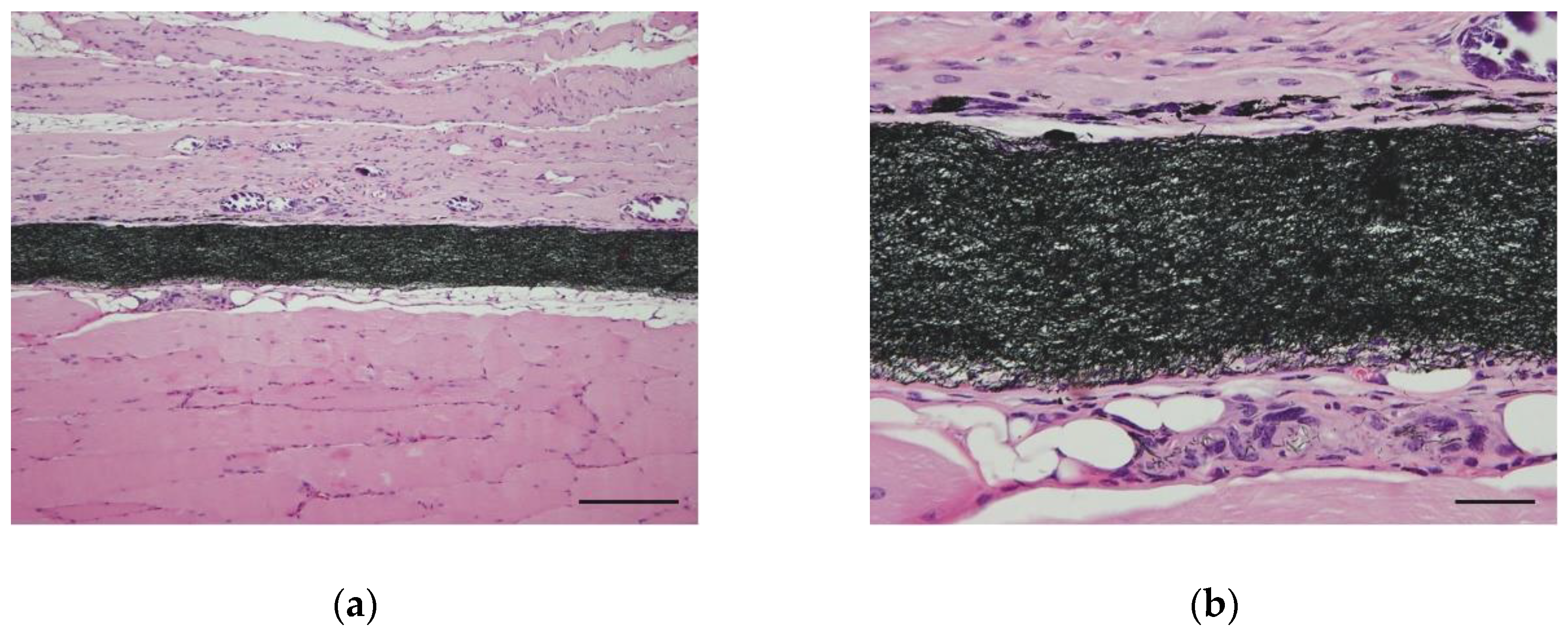 Nanomaterials 10 00562 g003