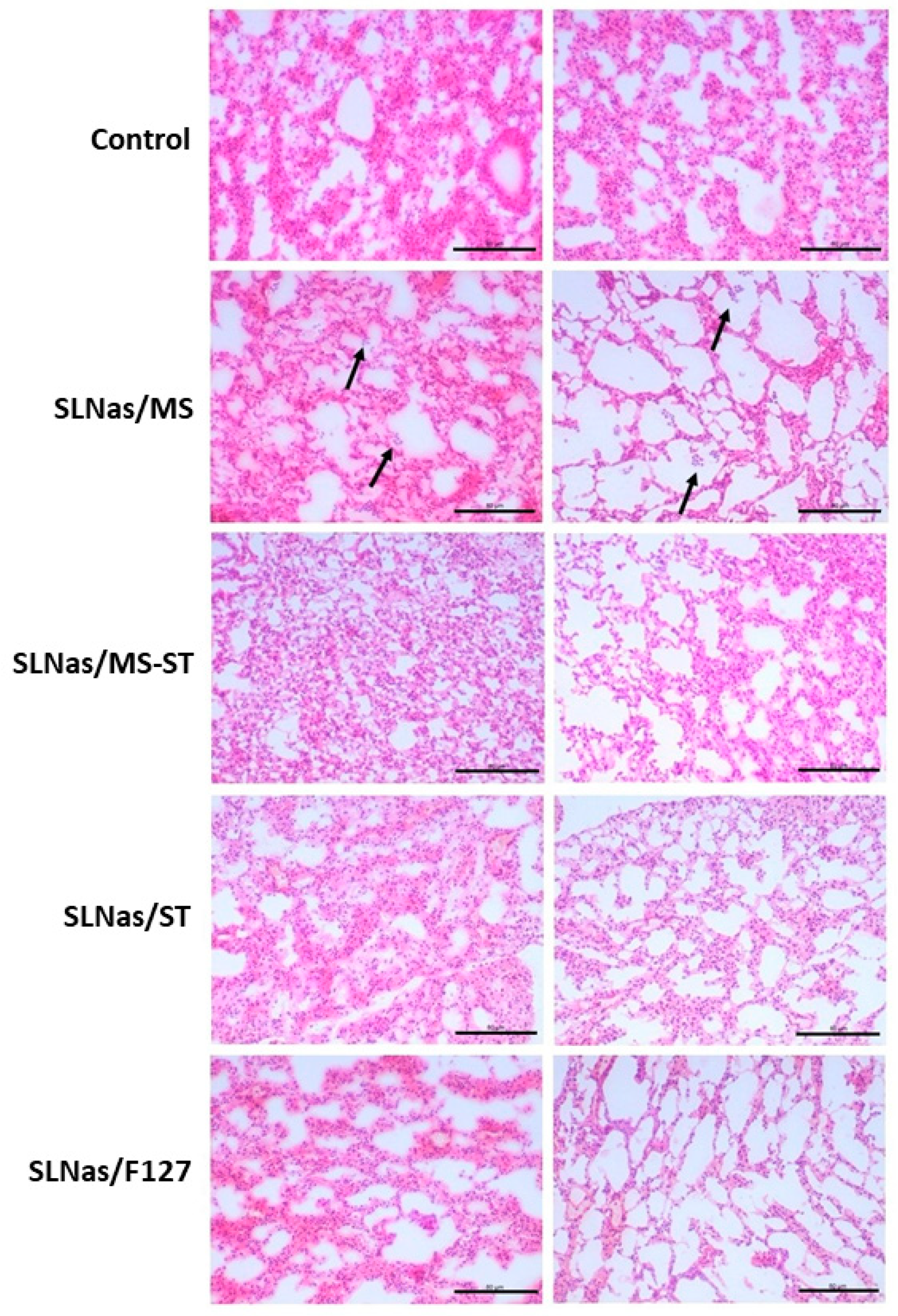 Nanomaterials 10 00568 g006