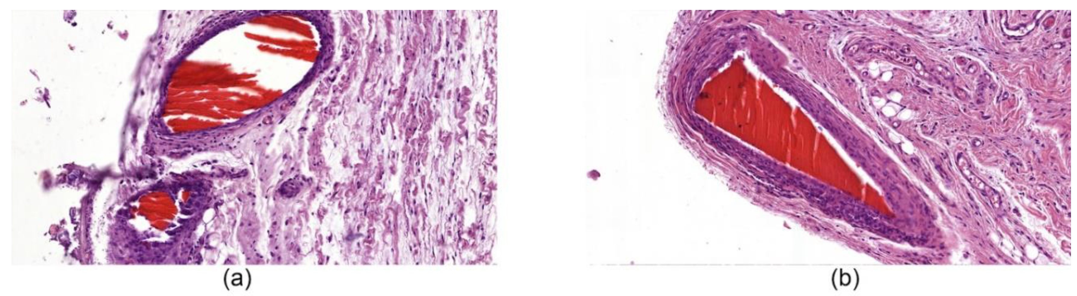 Nanomaterials 10 00945 g007