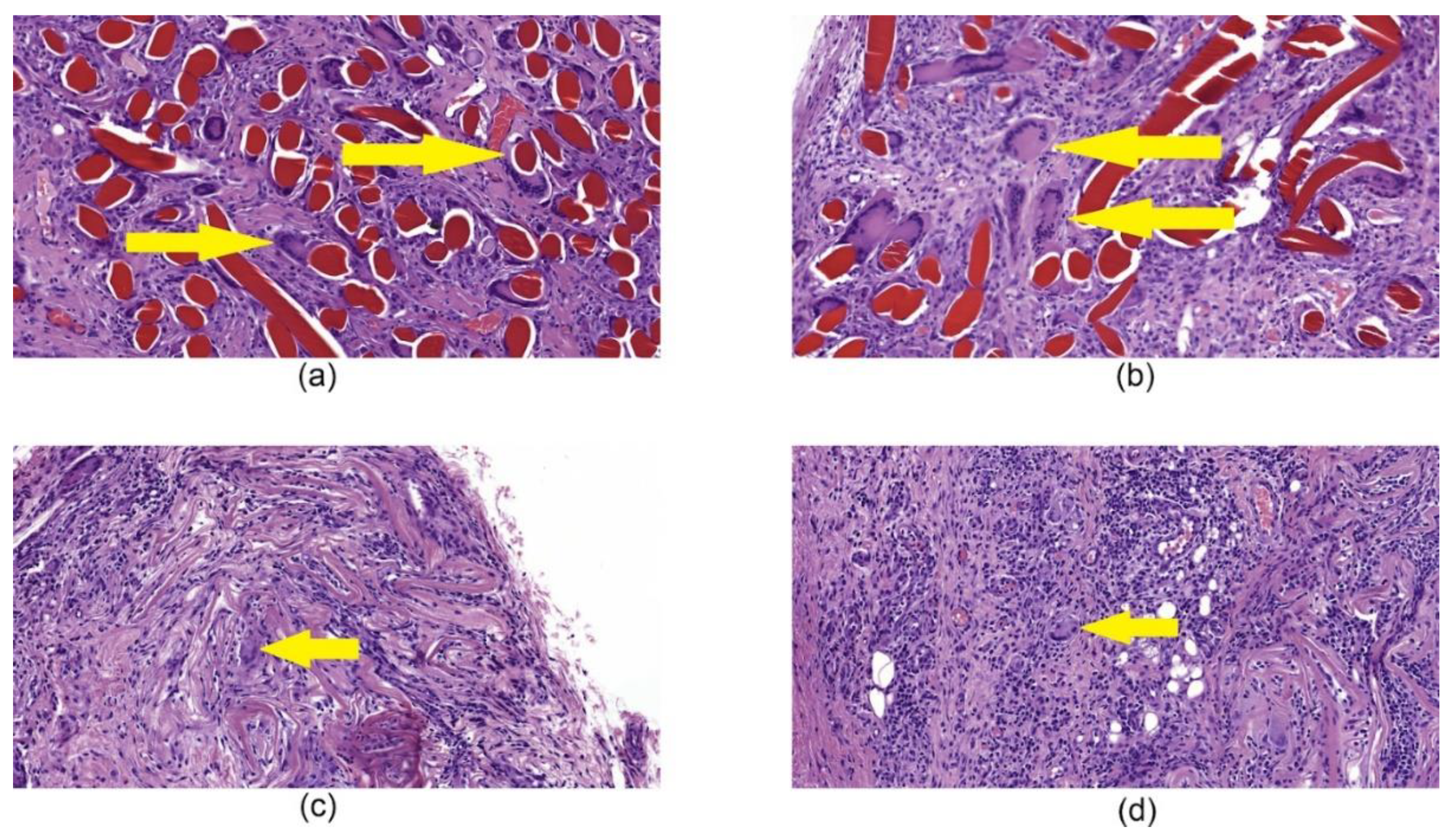 Nanomaterials 10 00945 g009