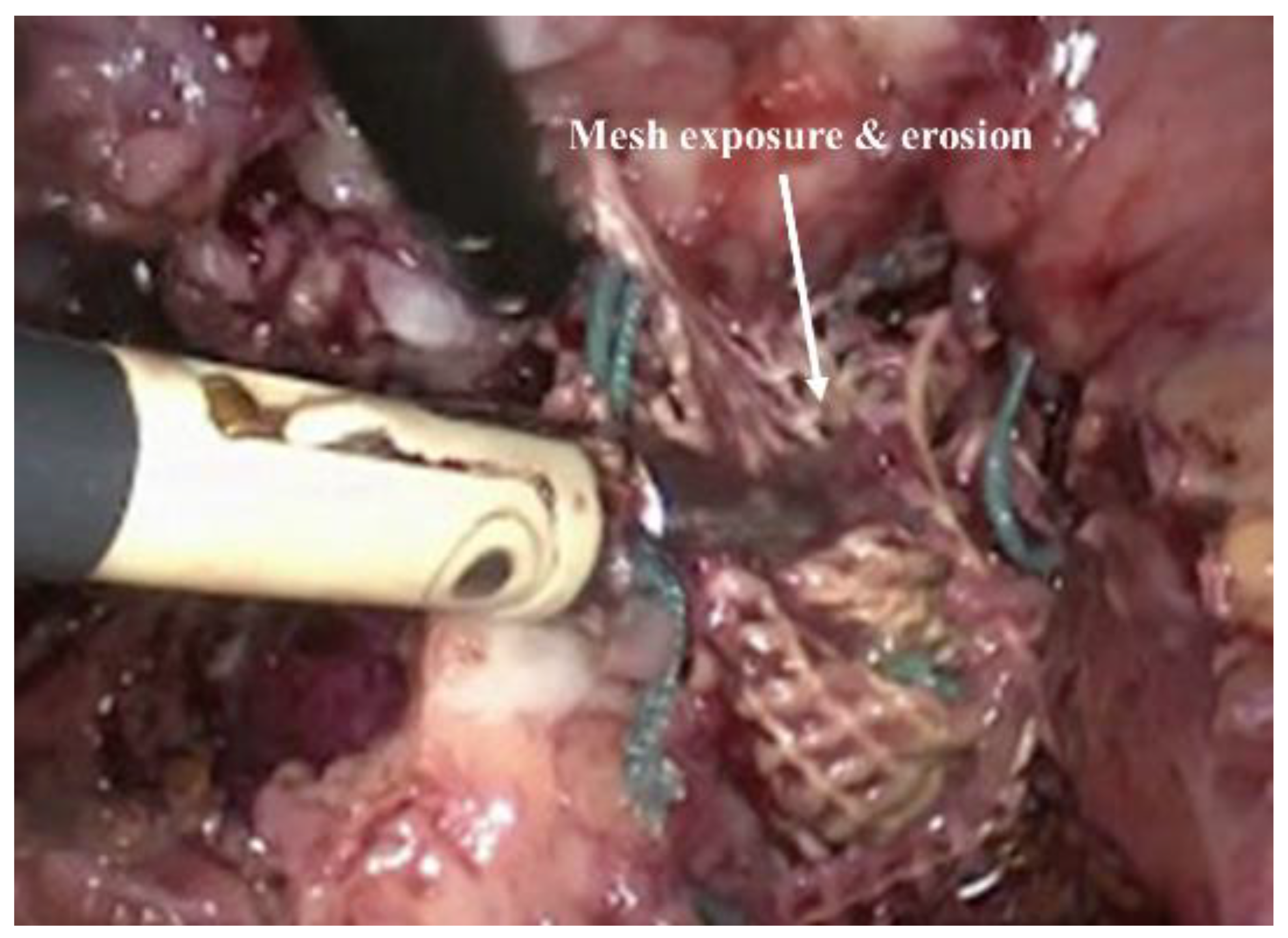 Nanomaterials 10 01120 g003 Nanomaterials 10 01120 g003