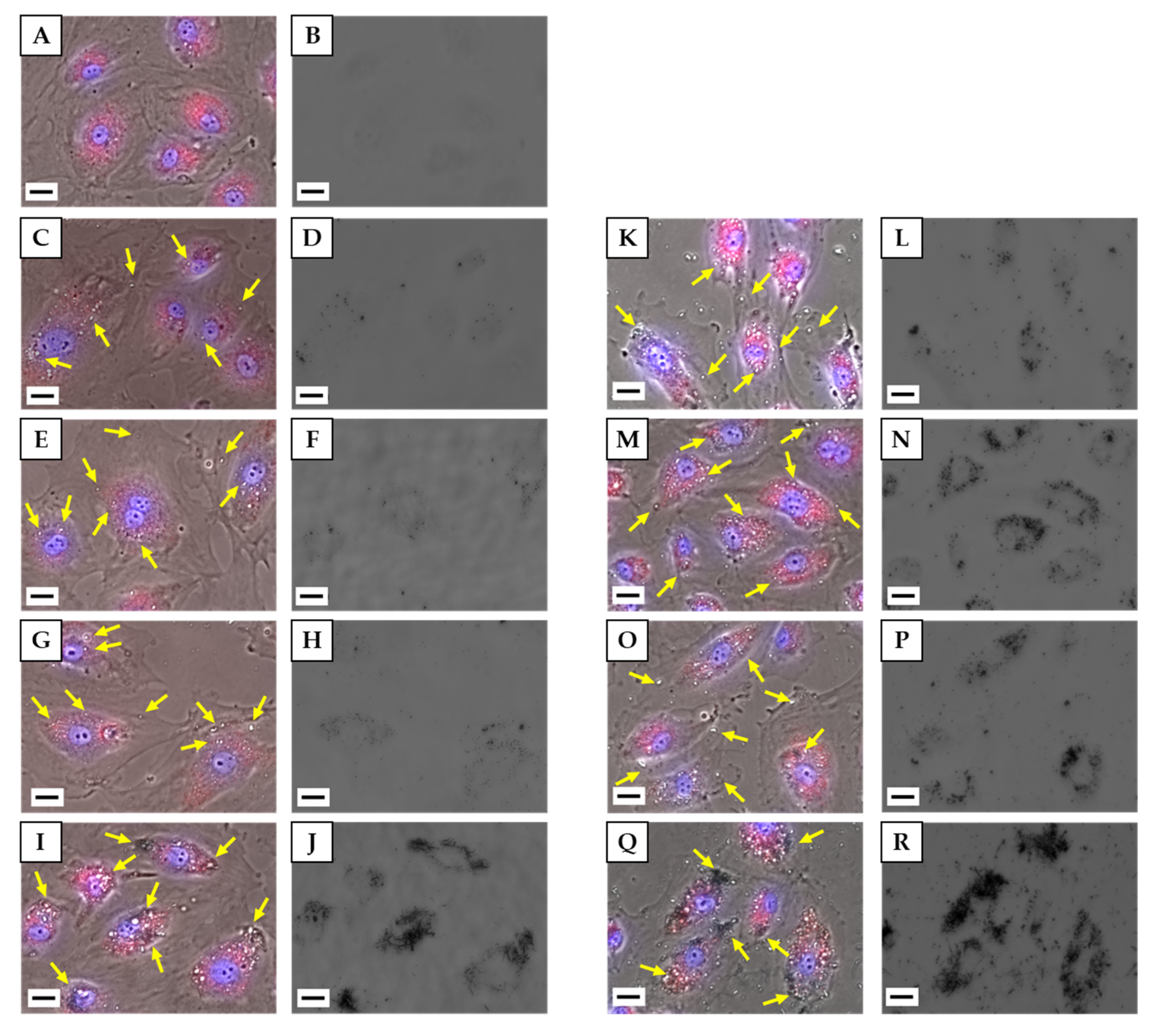 Nanomaterials Free Full Text Cellular Responses Of Human Lymphatic Endothelial Cells To Carbon Nanomaterials Html