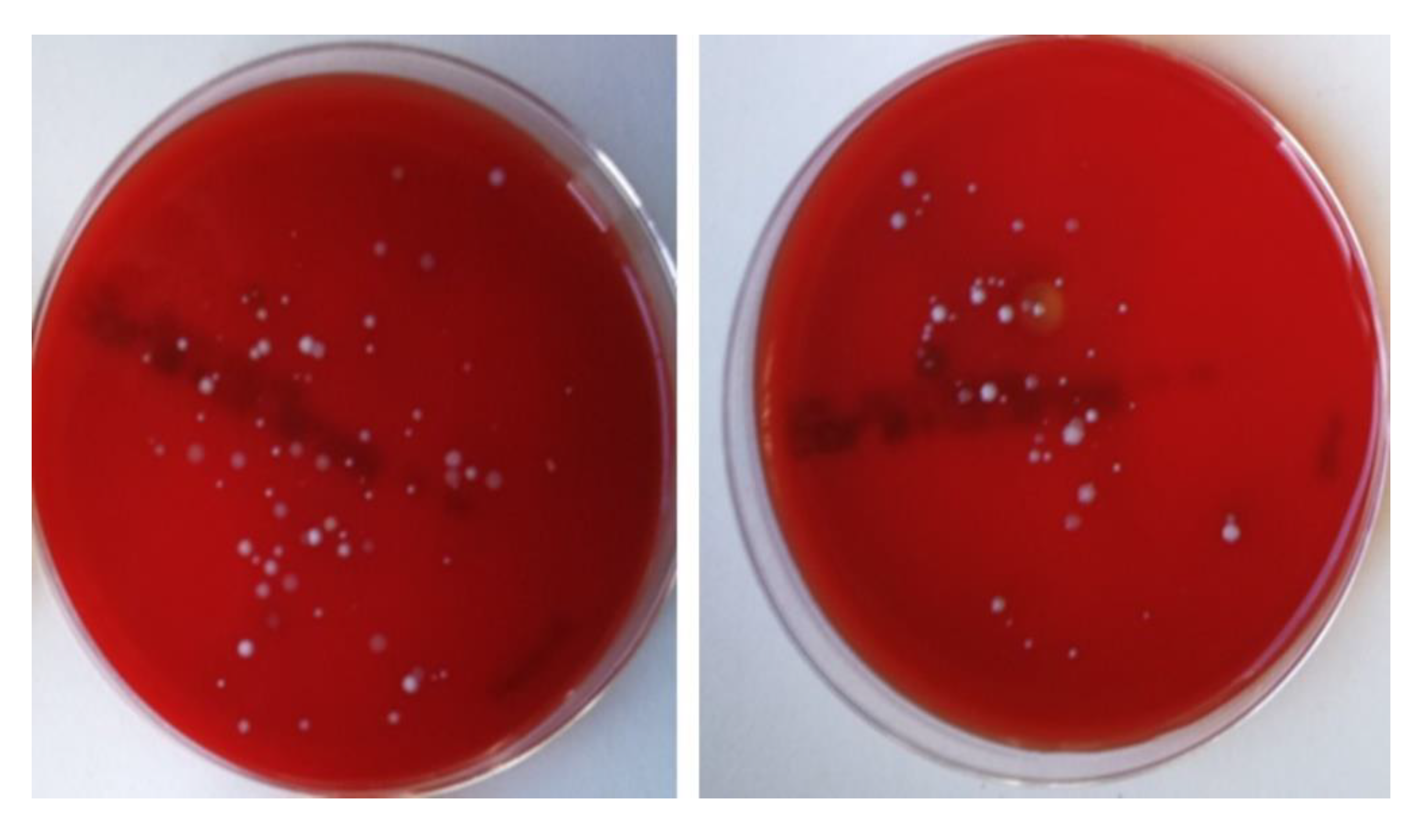Nanomaterials 10 01568 g006