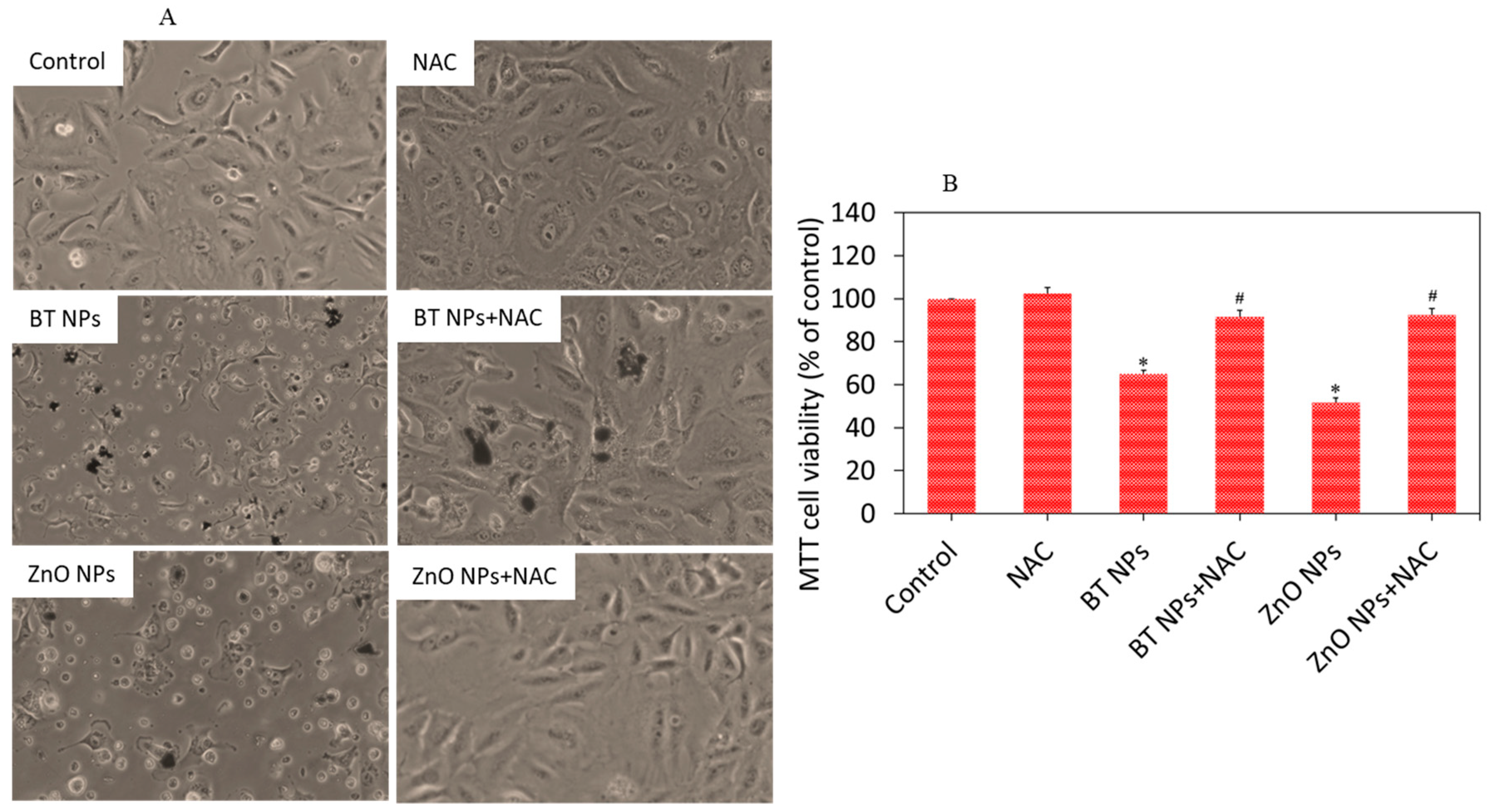 Nanomaterials 10 02309 g007 Nanomaterials 10 02309 g007