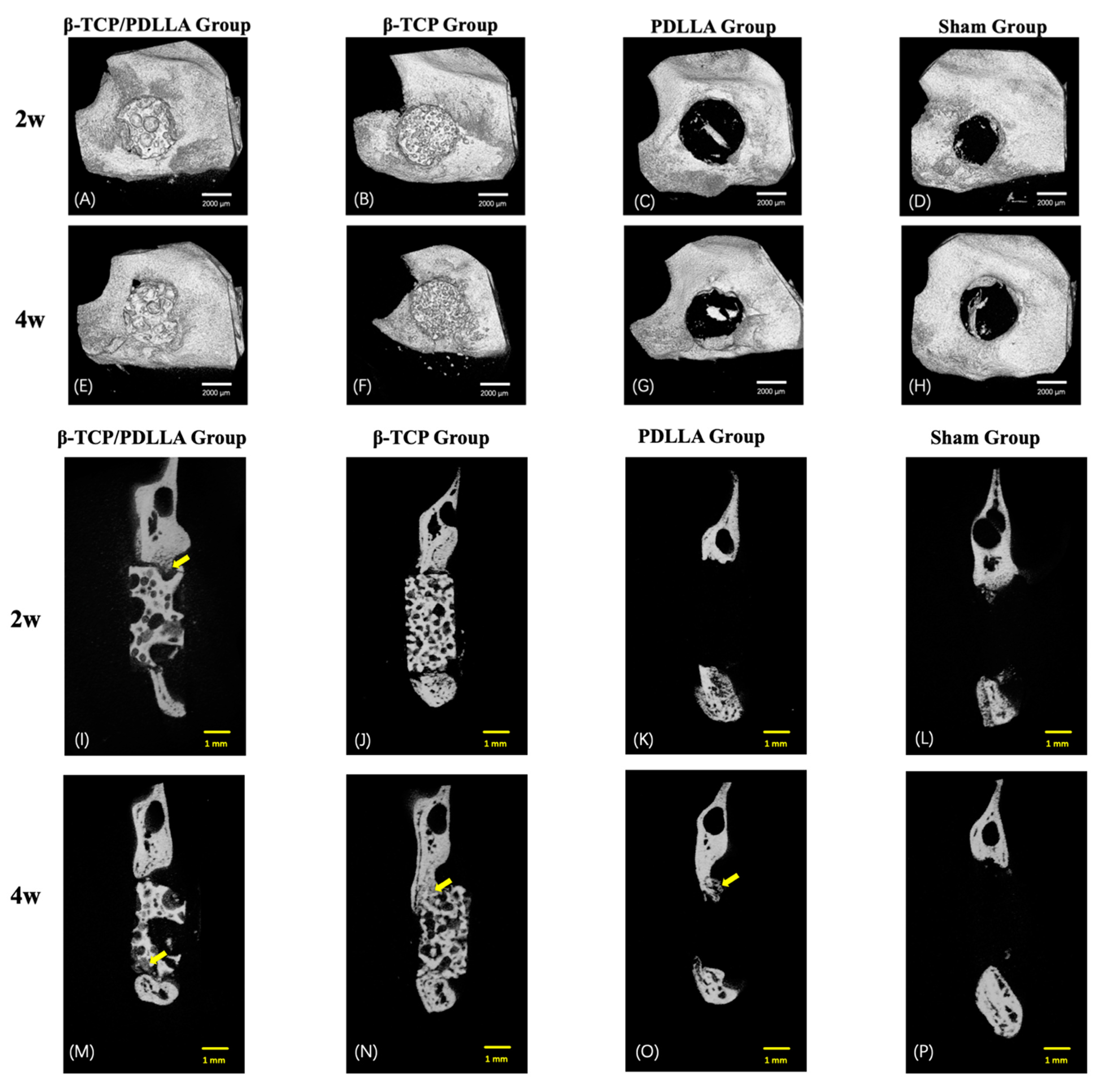 Nanomaterials Free Full Text Feasibility Of Application Of The Newly Developed Nano Biomaterial B Tcp Pdlla In Maxillofacial Reconstructive Surgery A Pilot Rat Study Html