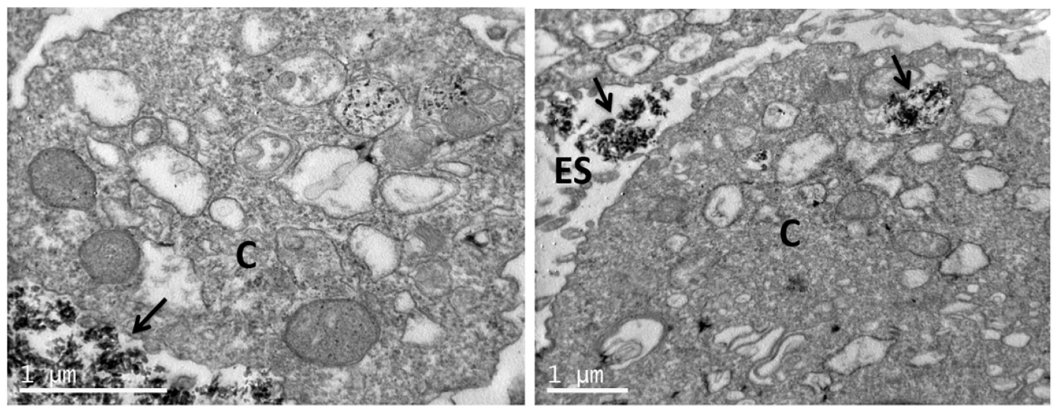 Nanomaterials 11 01152 g011