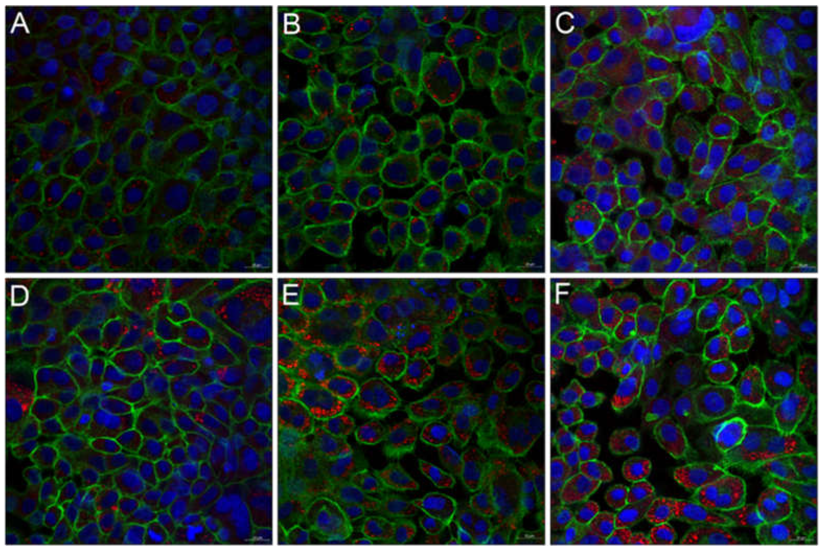 Nanomaterials 11 01330 g009 Nanomaterials 11 01330 g009