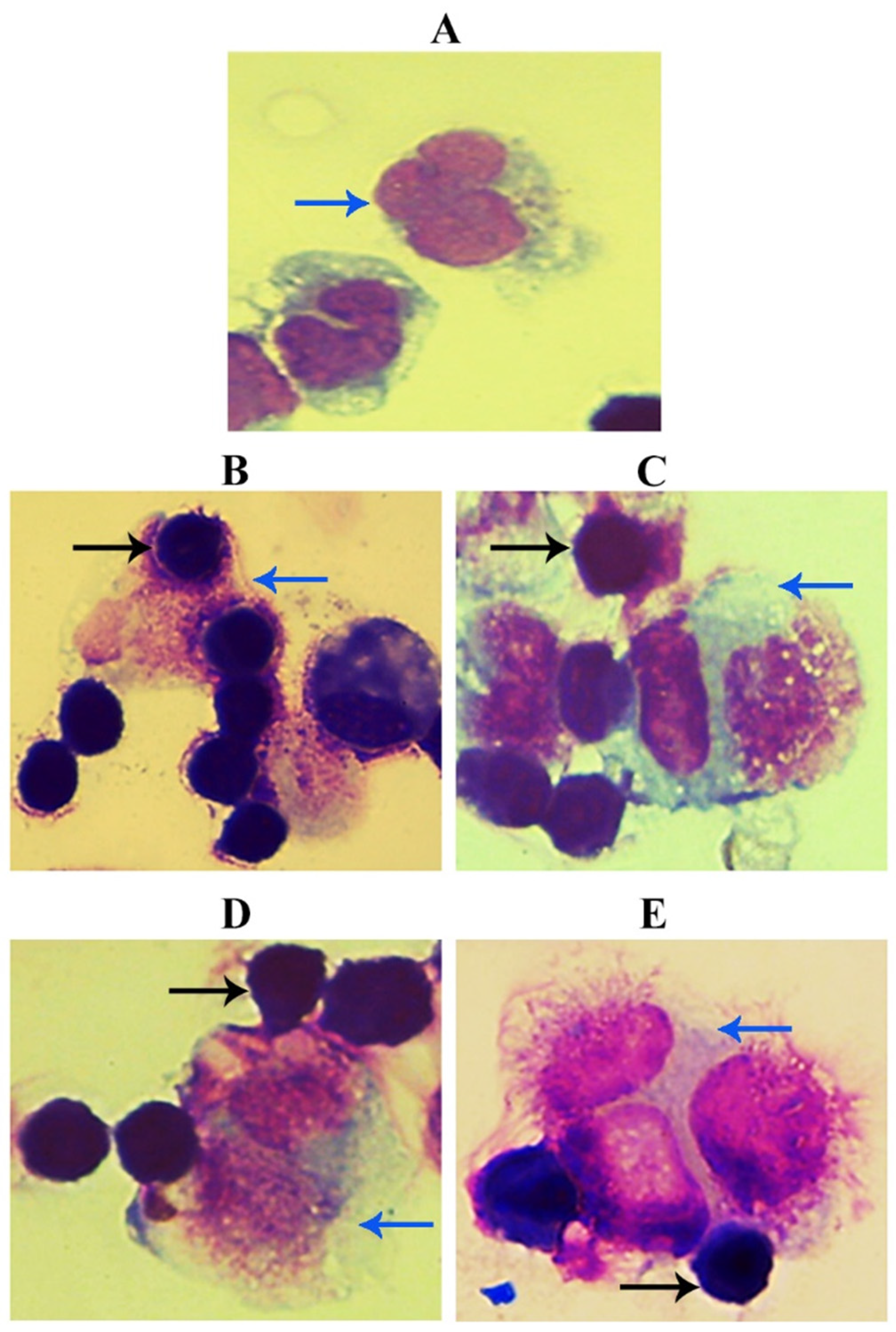 Nanomaterials 11 01382 g006