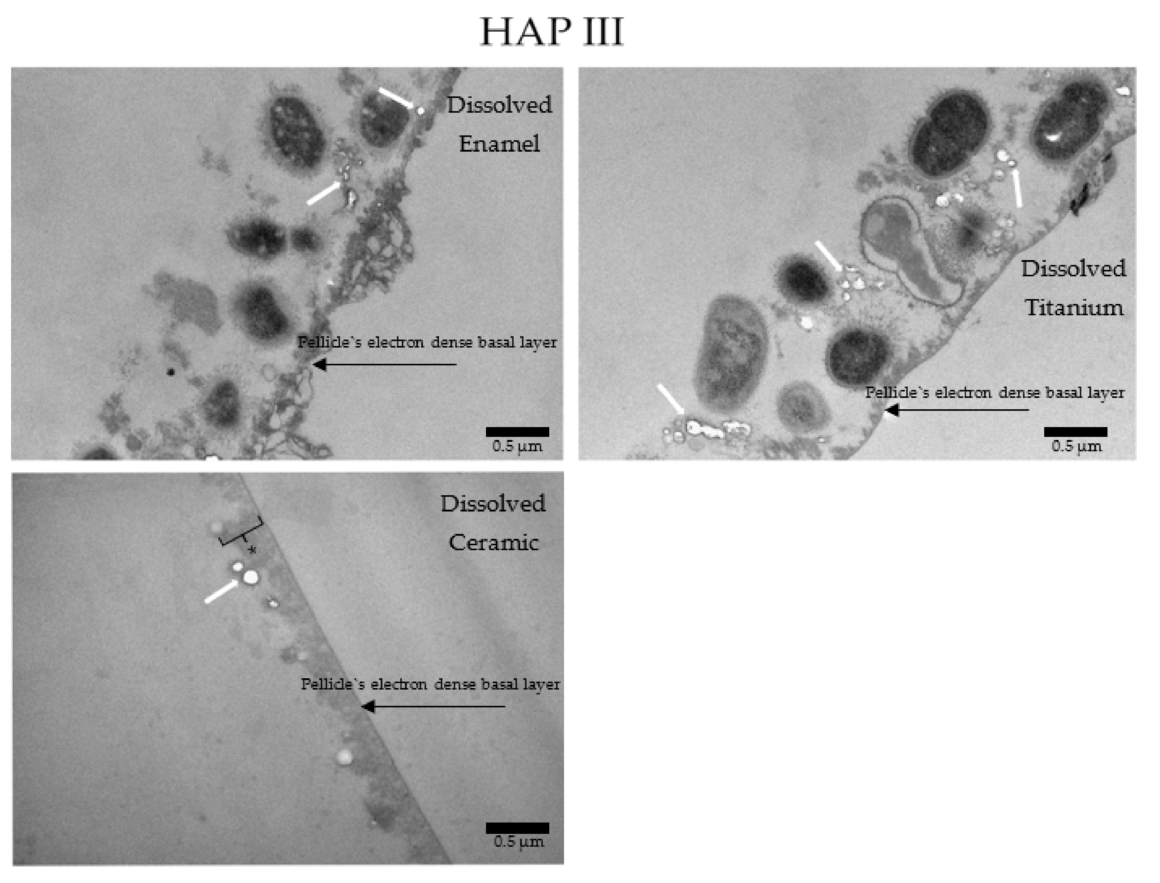 Nanomaterials 11 02452 g017