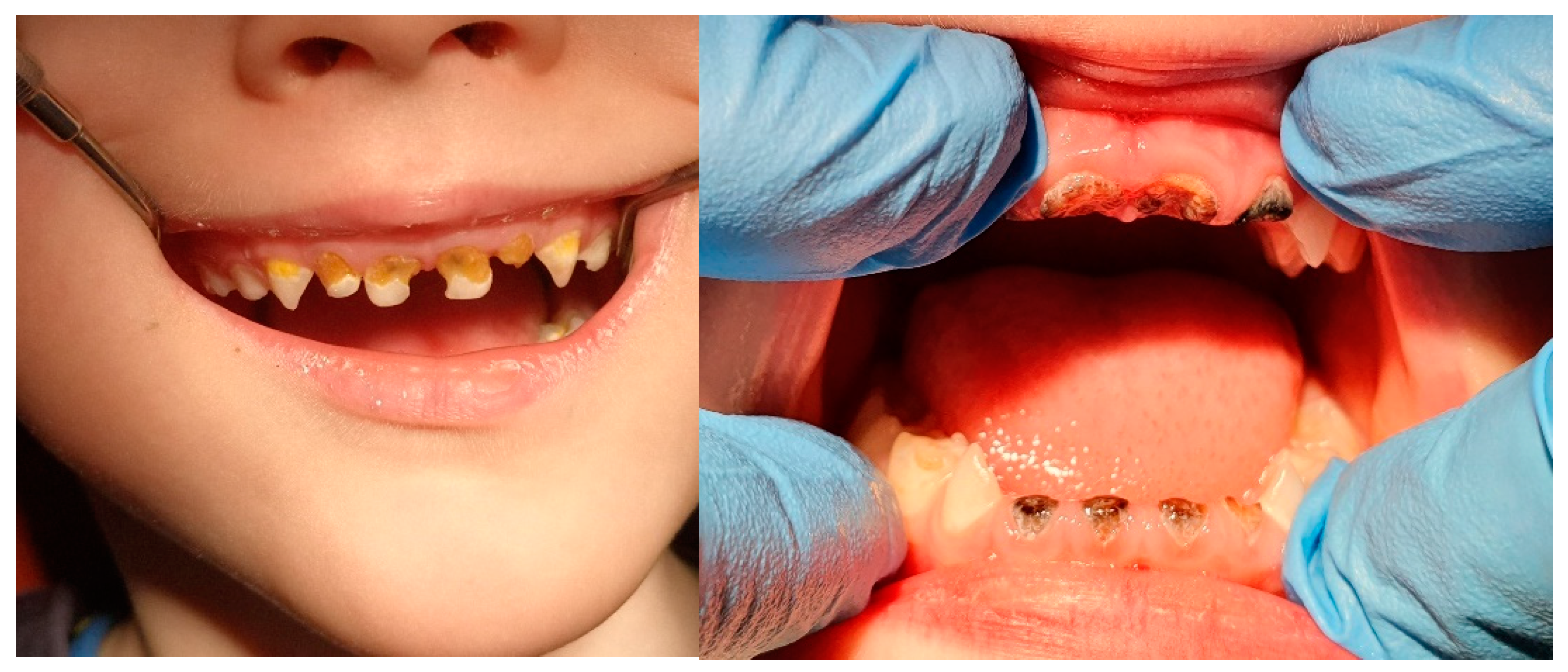 Nanomaterials 11 03374 g002 Nanomaterials 11 03374 g002