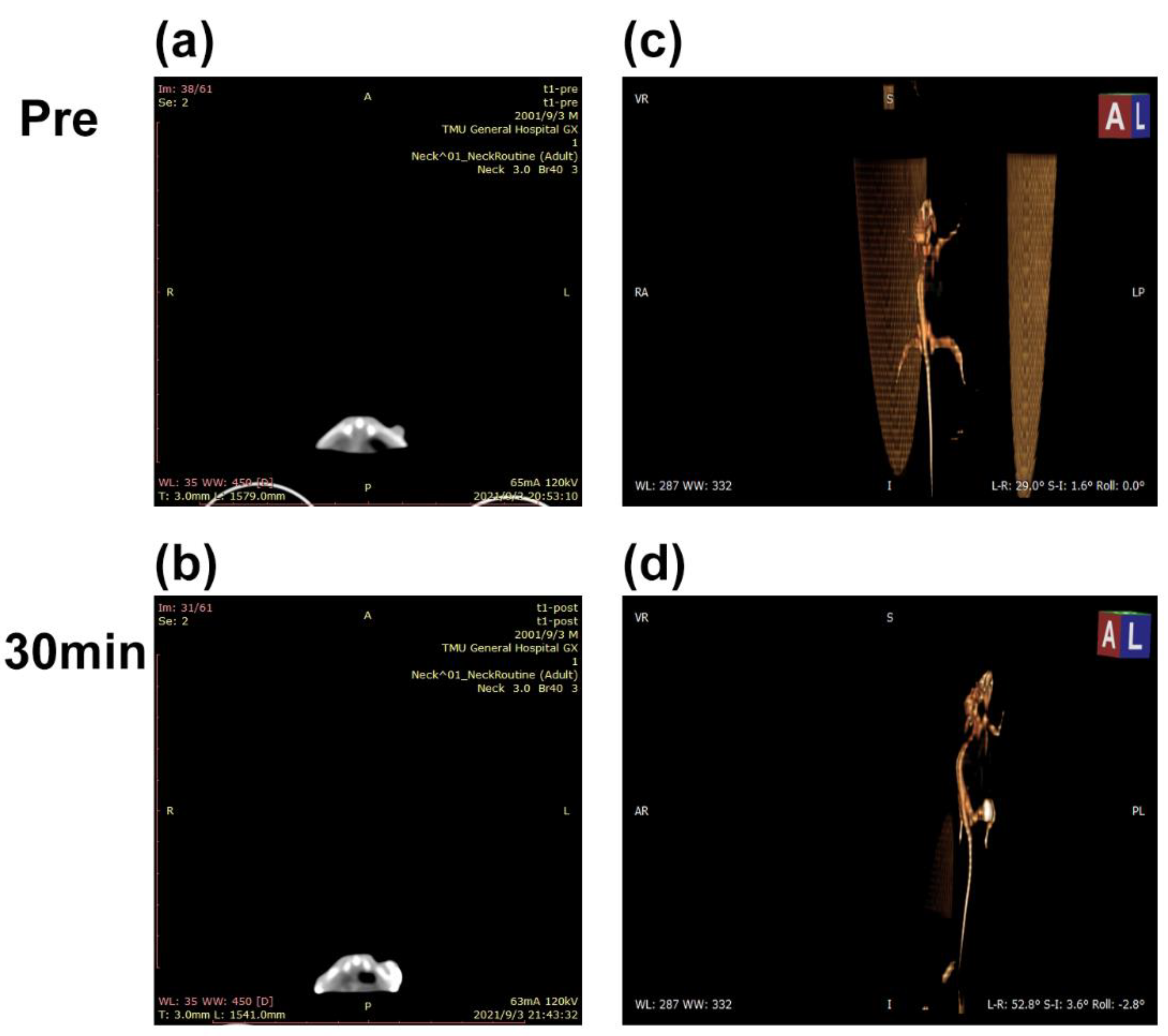 Nanomaterials 11 03395 g011
