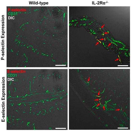 Contrast Enhanced Ultrasound Molecular Imaging of Spontaneous
