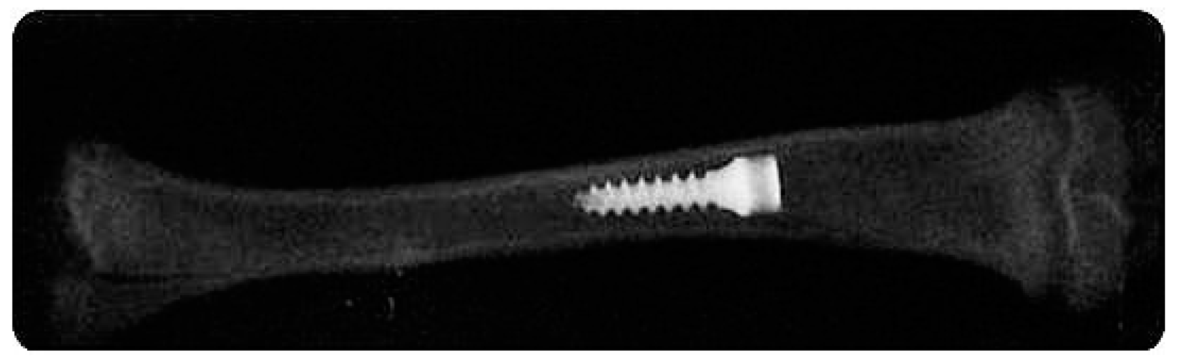 Nanomaterials 12 00782 g006