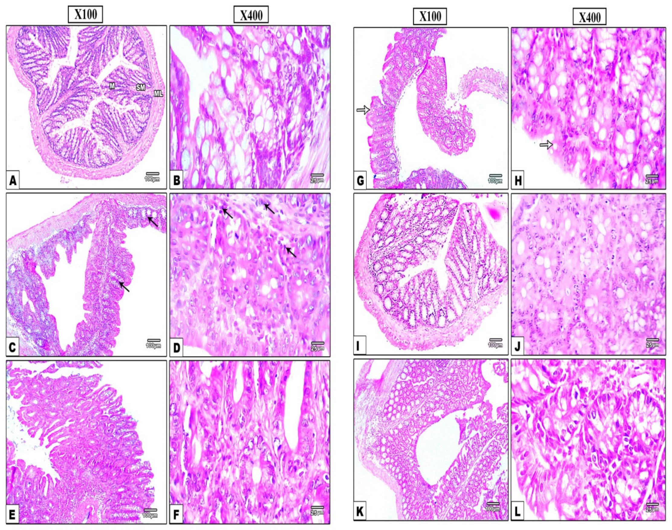 Nanomaterials 12 00857 g006
