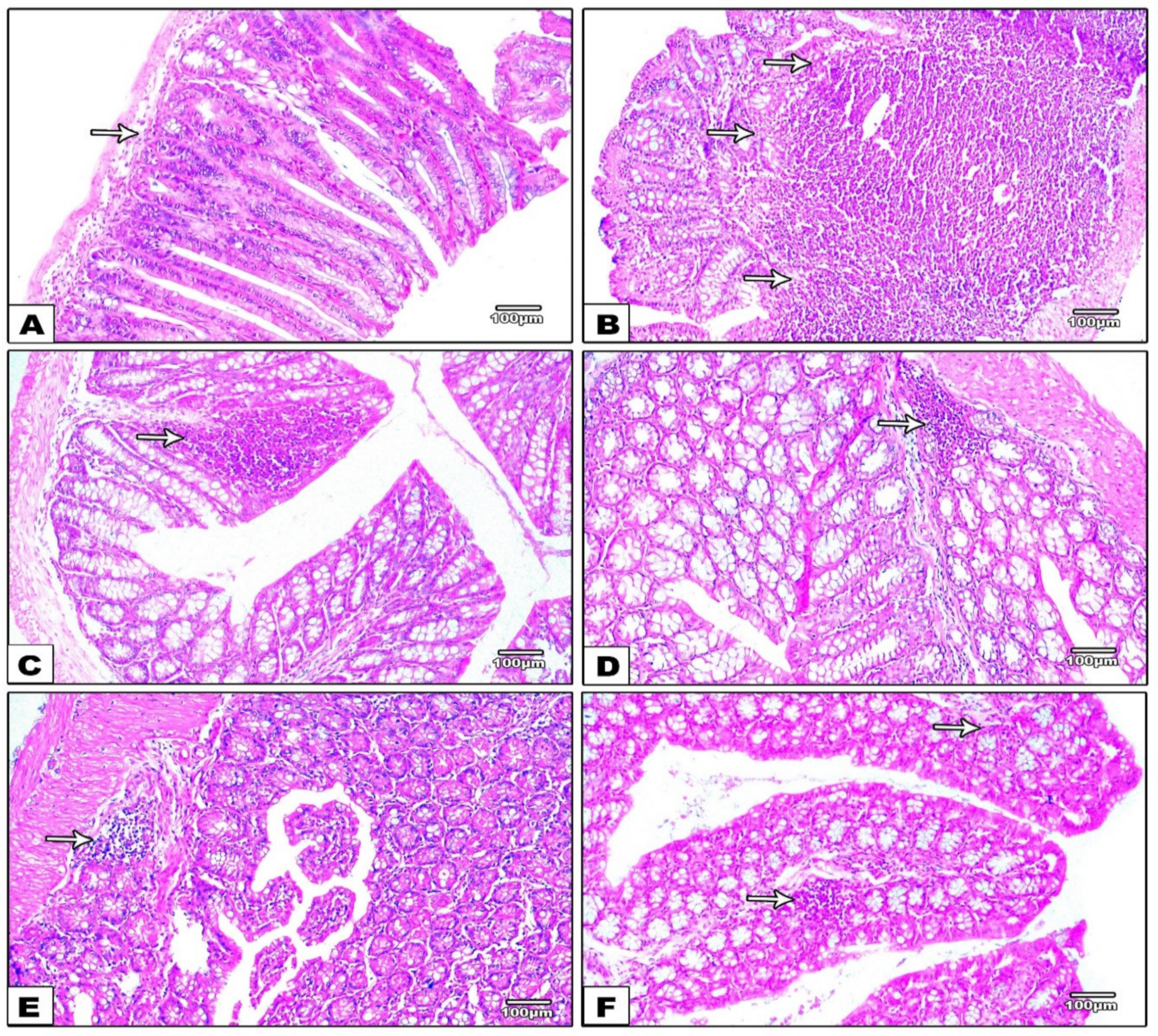 Nanomaterials 12 00857 g007