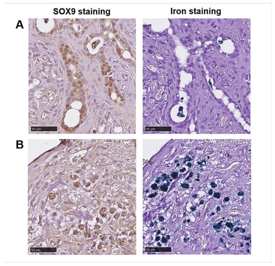 Magnetic Resonance Imaging of Transplanted Porcine Neonatal