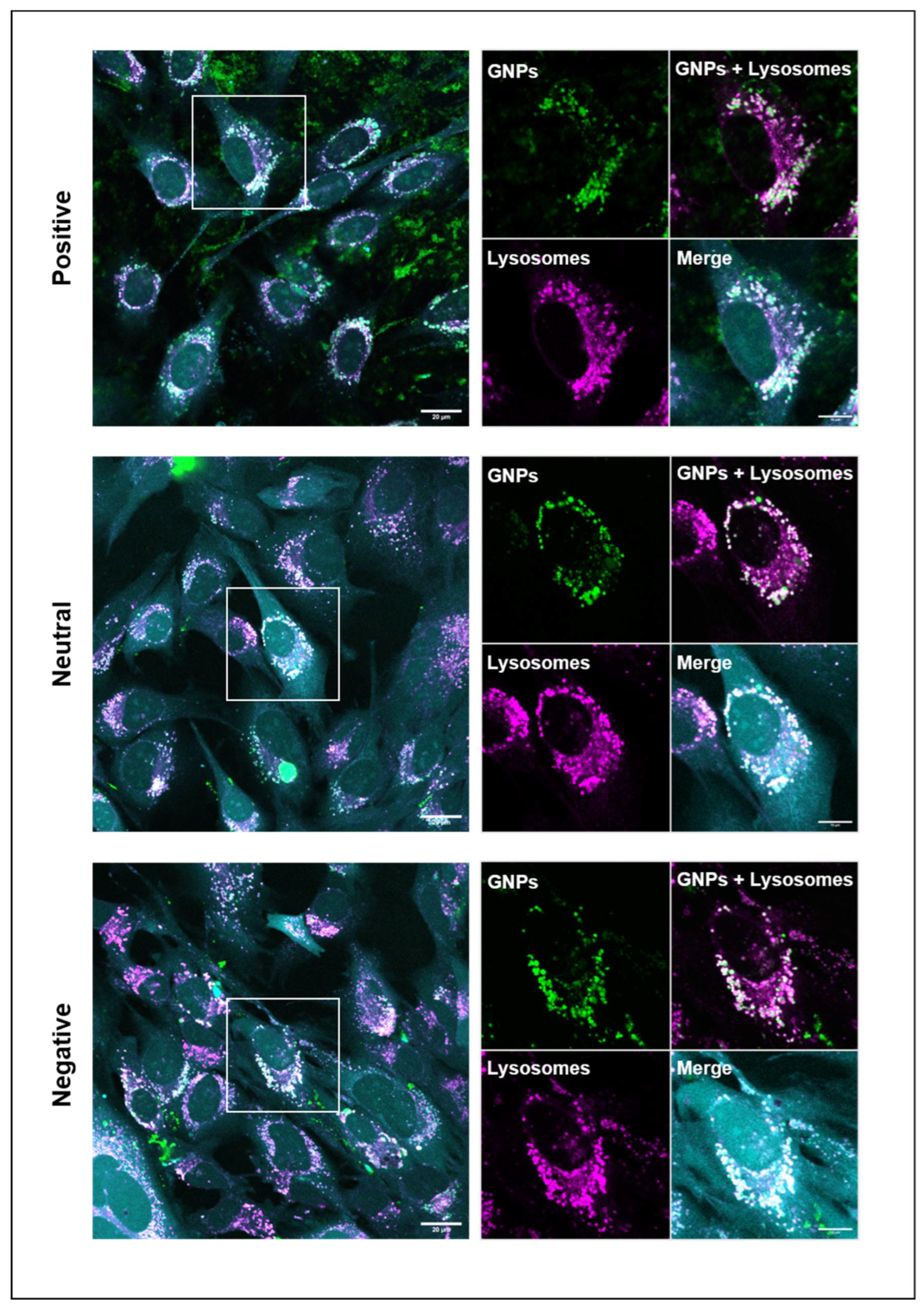 Nanomaterials 12 03423 g004 Nanomaterials 12 03423 g004