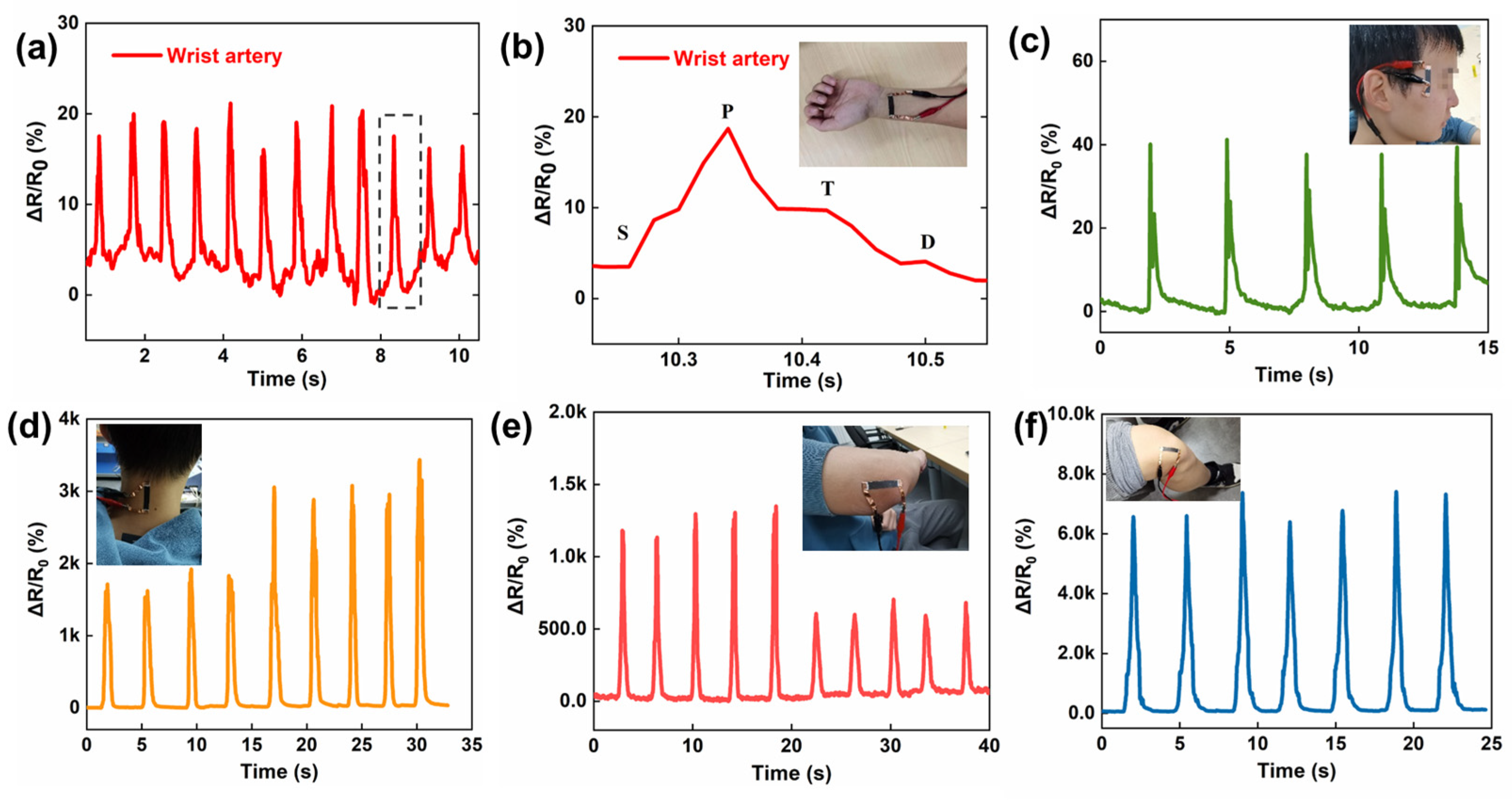 Nanomaterials 13 00179 g004