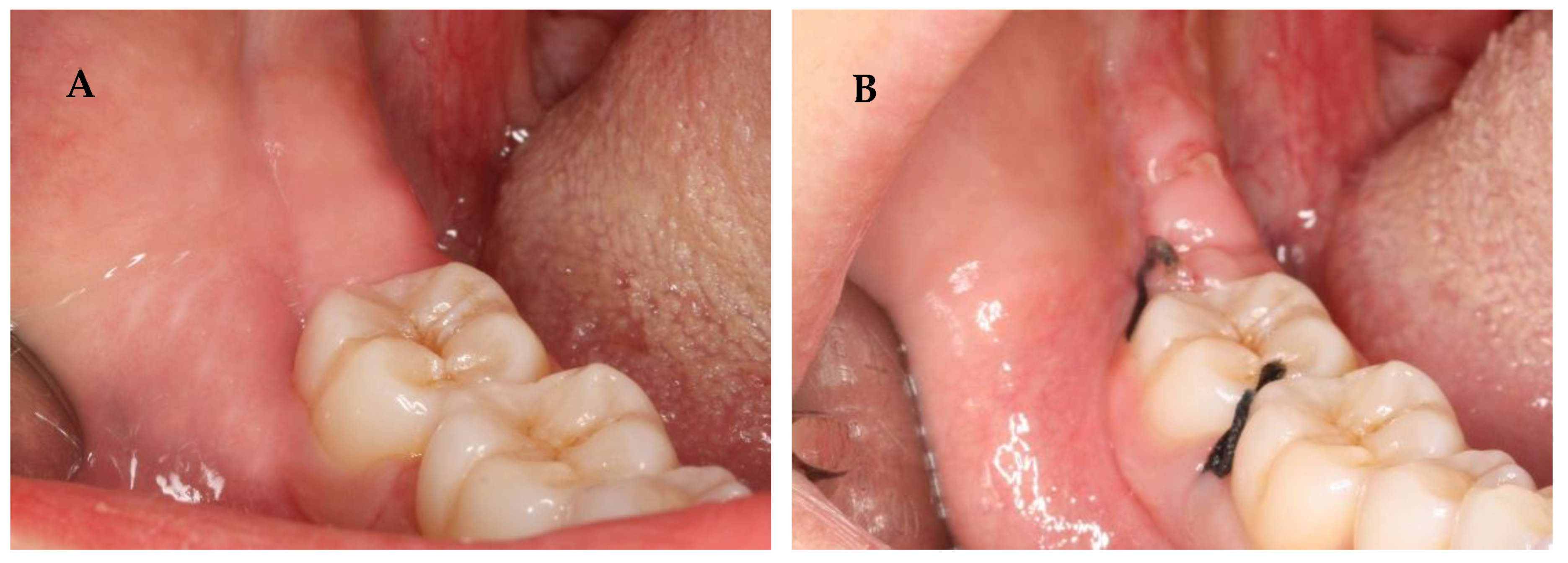 Nanomaterials 13 00706 g003 Nanomaterials 13 00706 g003