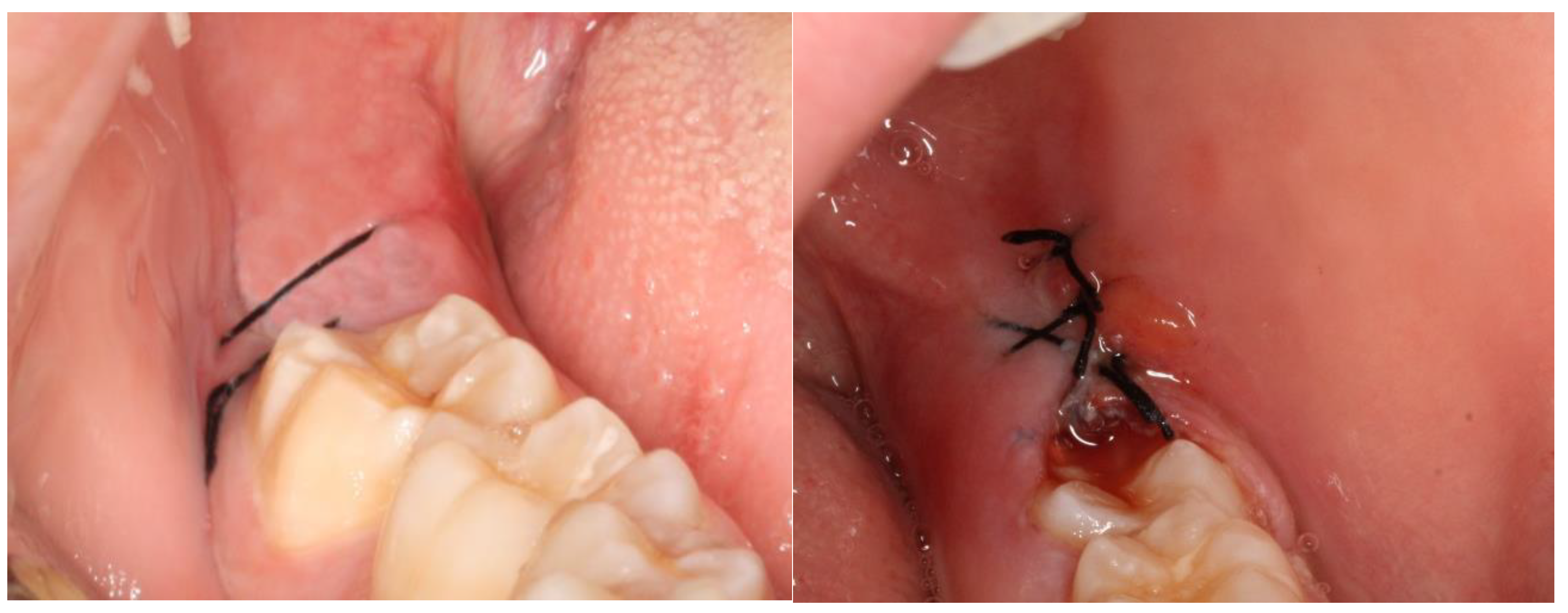 Nanomaterials 13 00706 g006 Nanomaterials 13 00706 g006