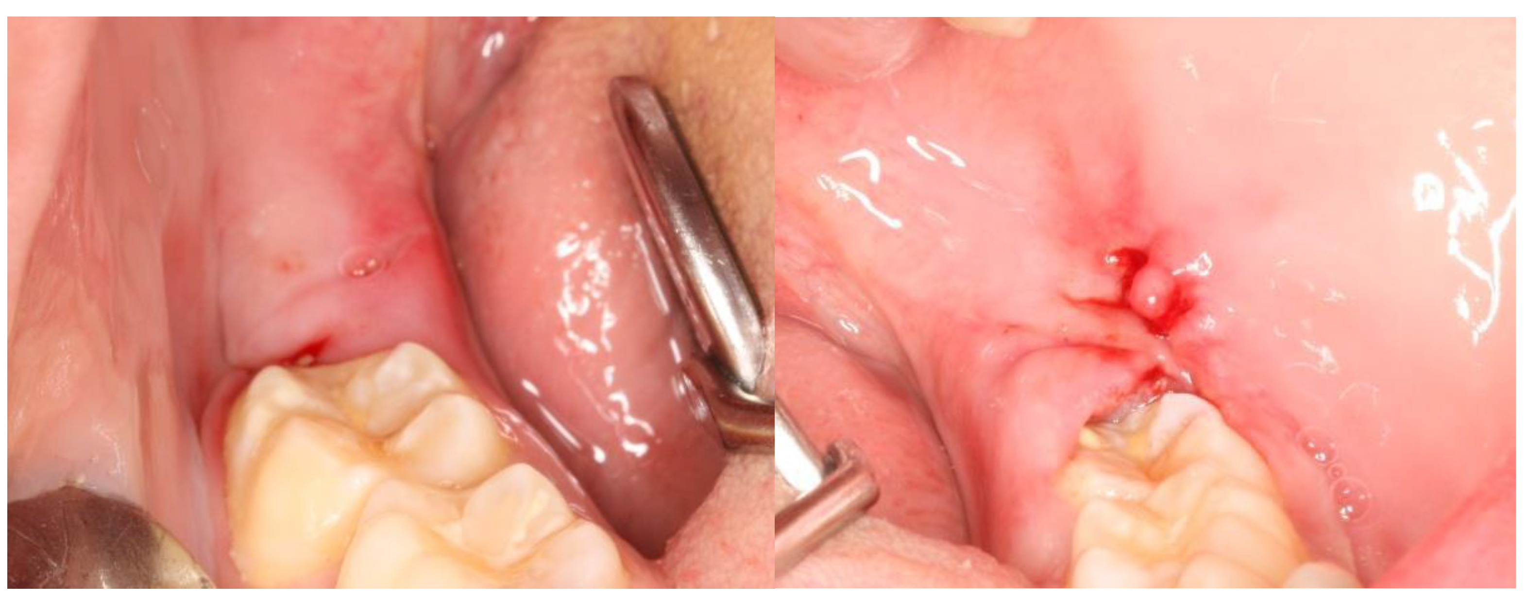 Nanomaterials 13 00706 g007 Nanomaterials 13 00706 g007