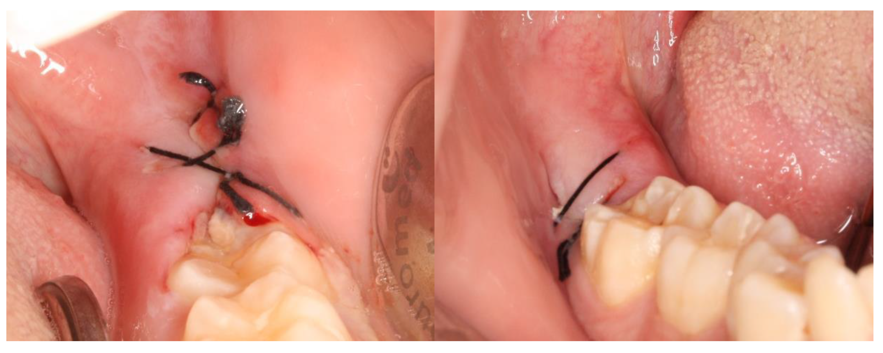 Nanomaterials 13 00706 g008 Nanomaterials 13 00706 g008