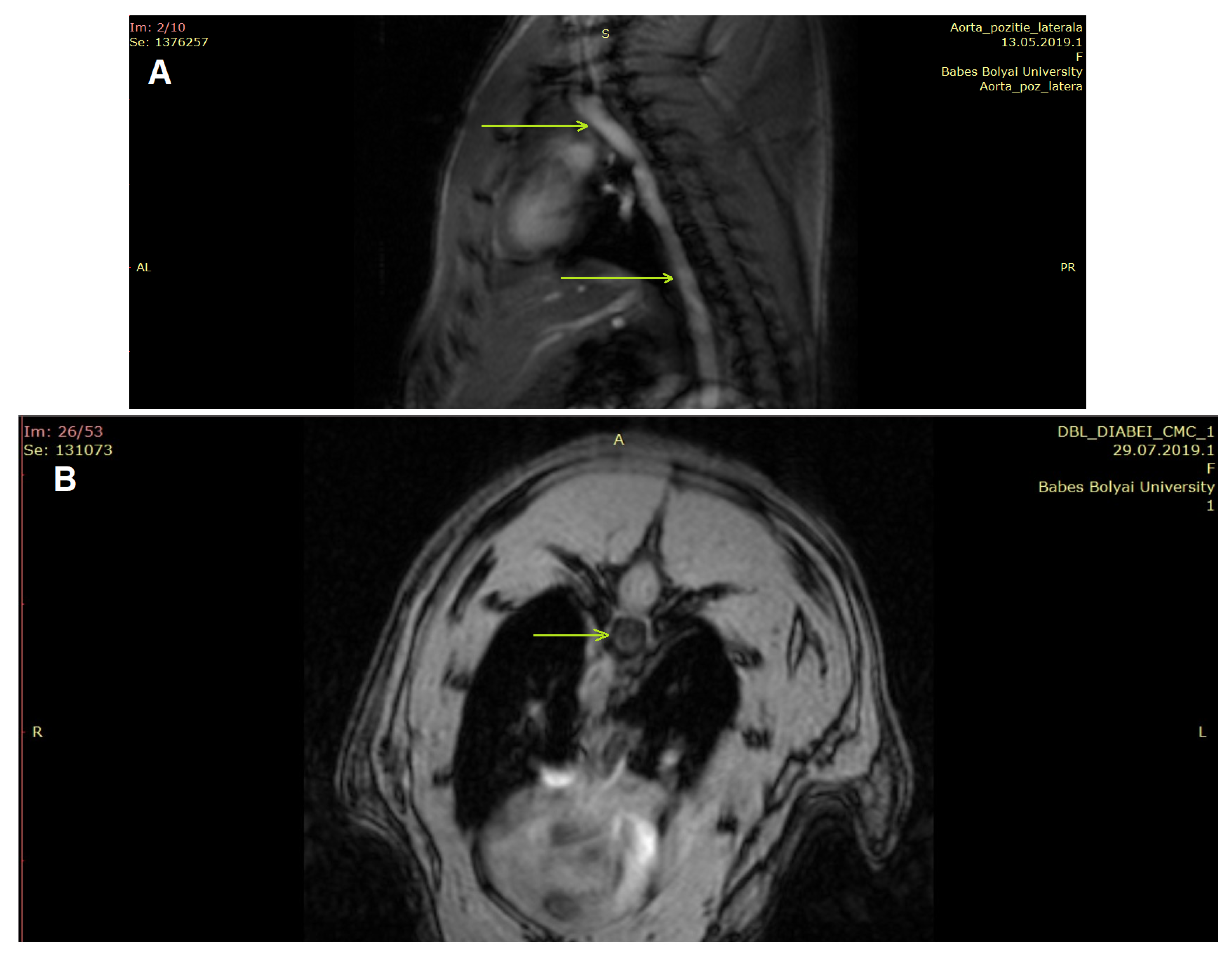 Nanomaterials 13 01101 g001