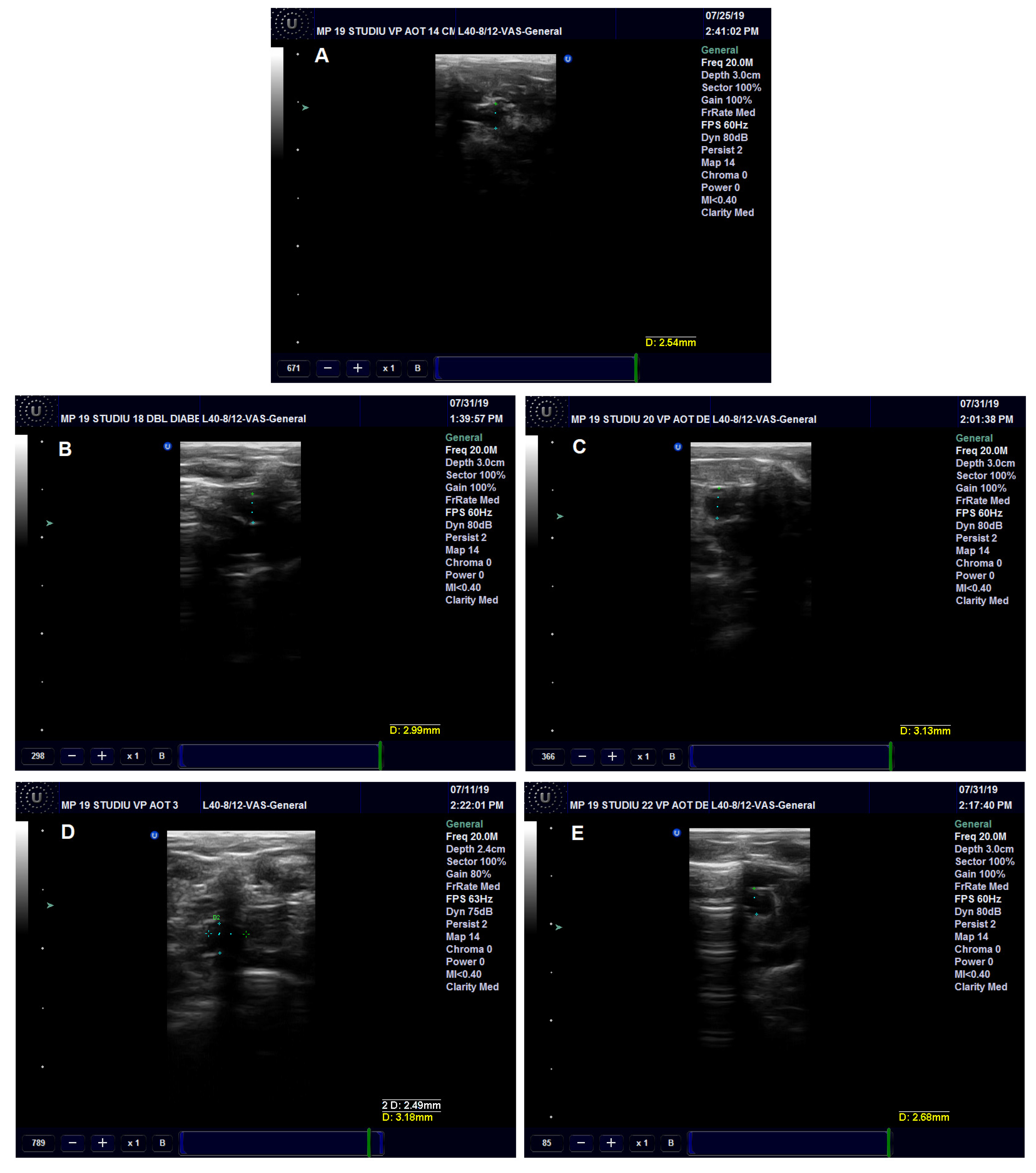 Nanomaterials 13 01101 g005