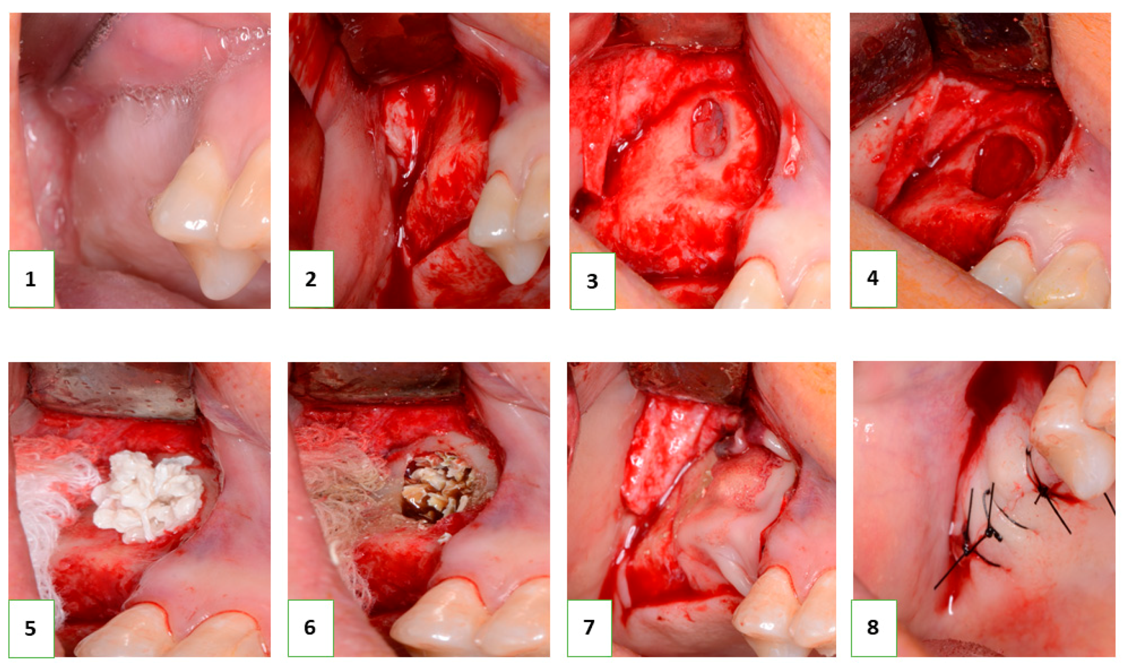 Nanomaterials 13 01876 g002