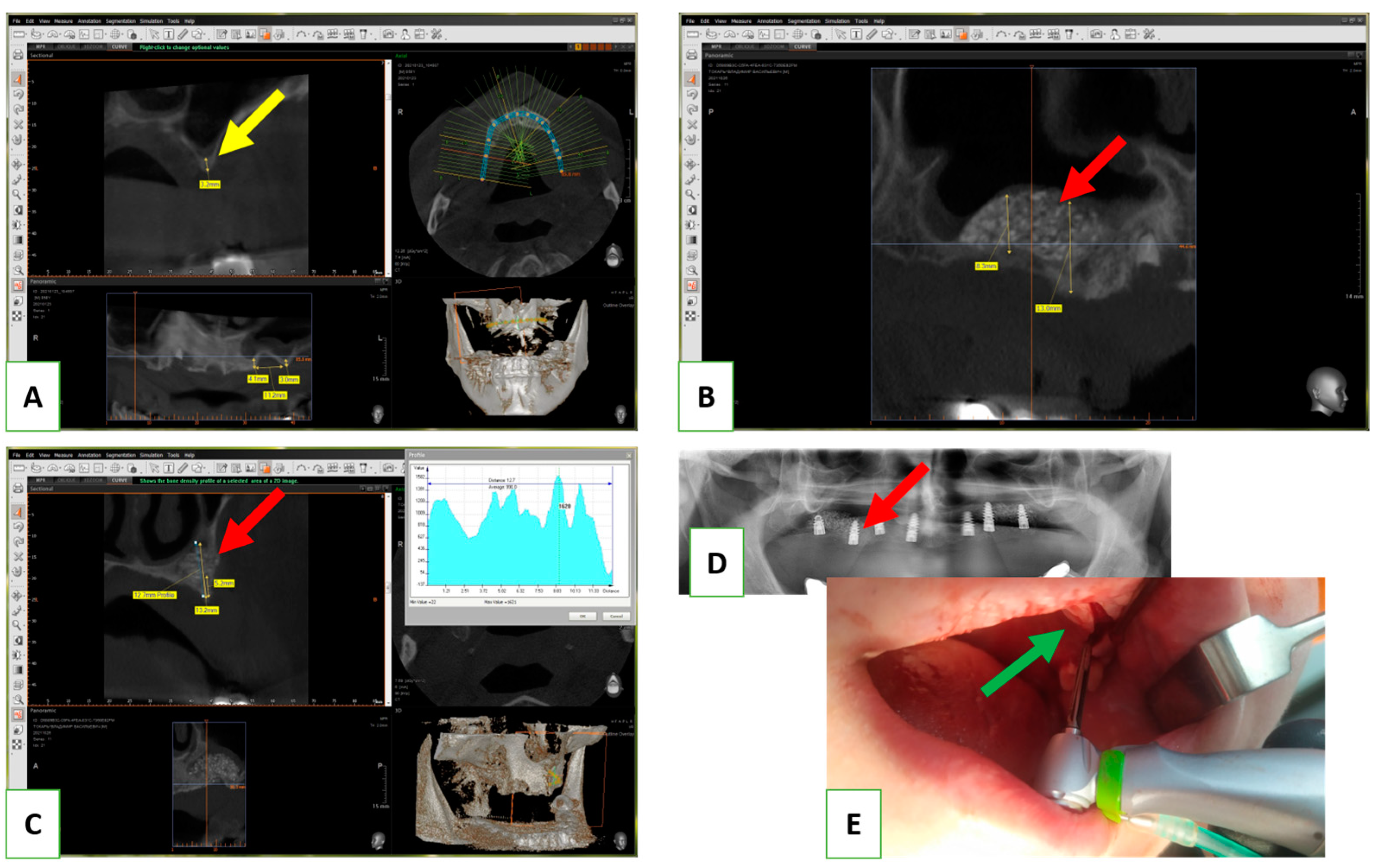 Nanomaterials 13 01876 g008