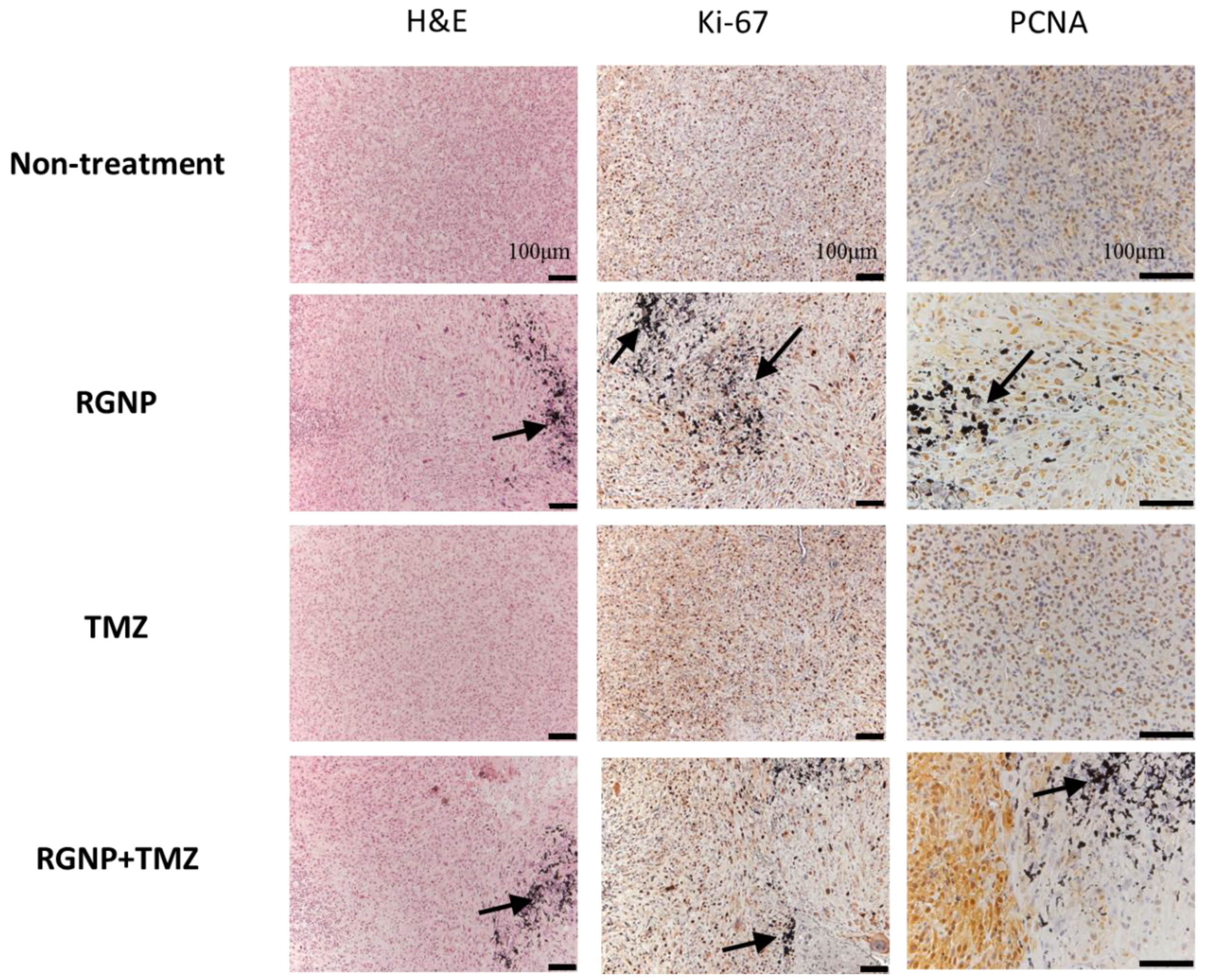 Nanomaterials 13 02821 g005 Nanomaterials 13 02821 g005